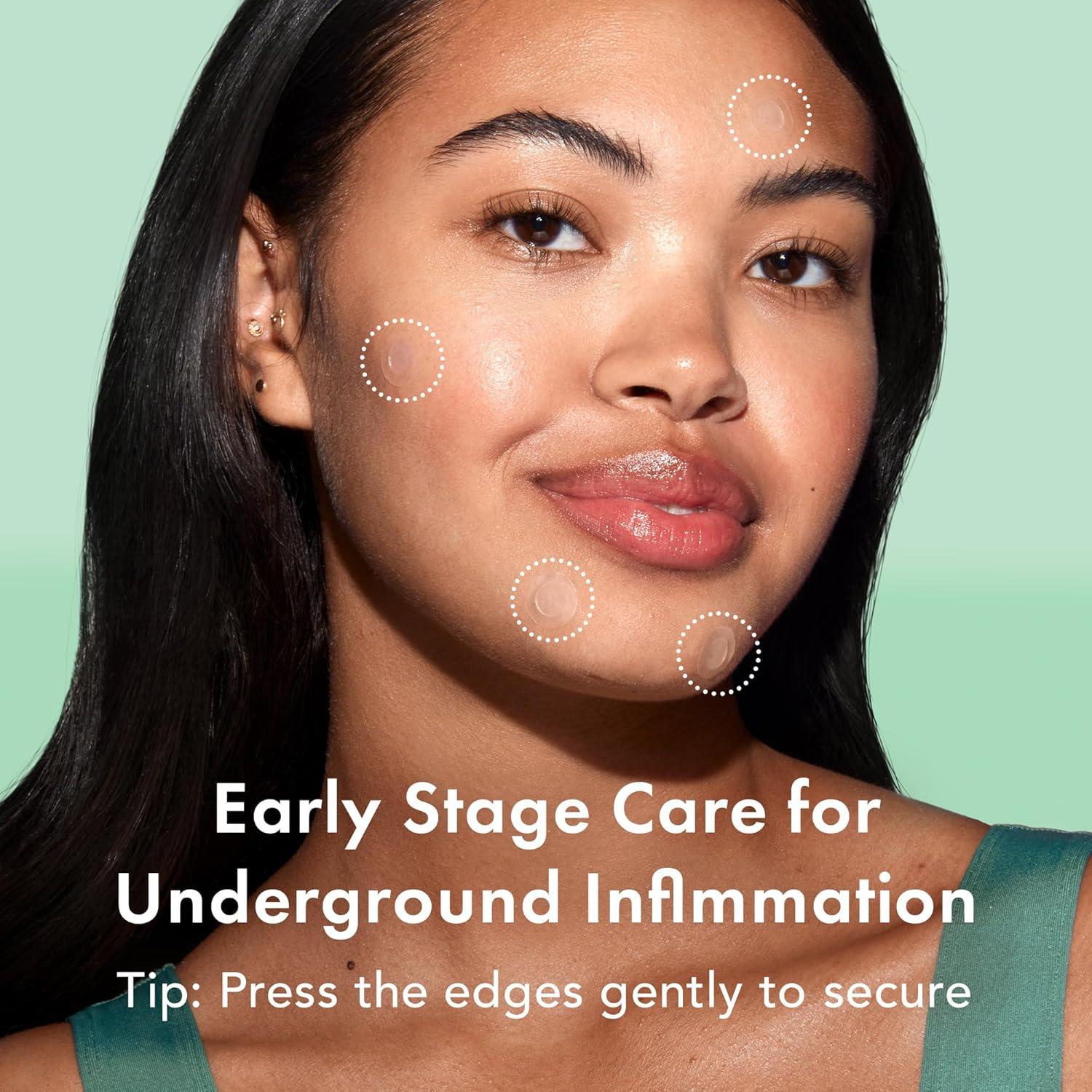 Parche Hidrocoloide para Acné Rael - Invisible, Vegano, 33 Unidades