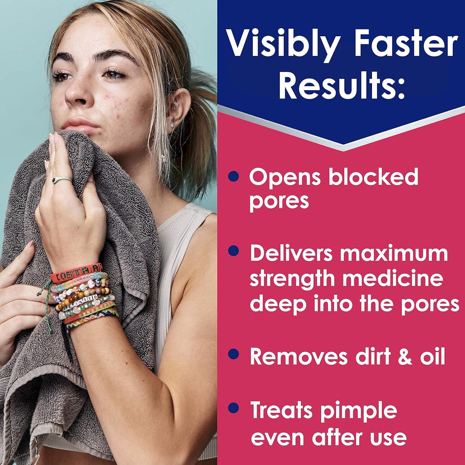 Almohadillas Clearasil Ultra 90 Unidades - Tratamiento Acné