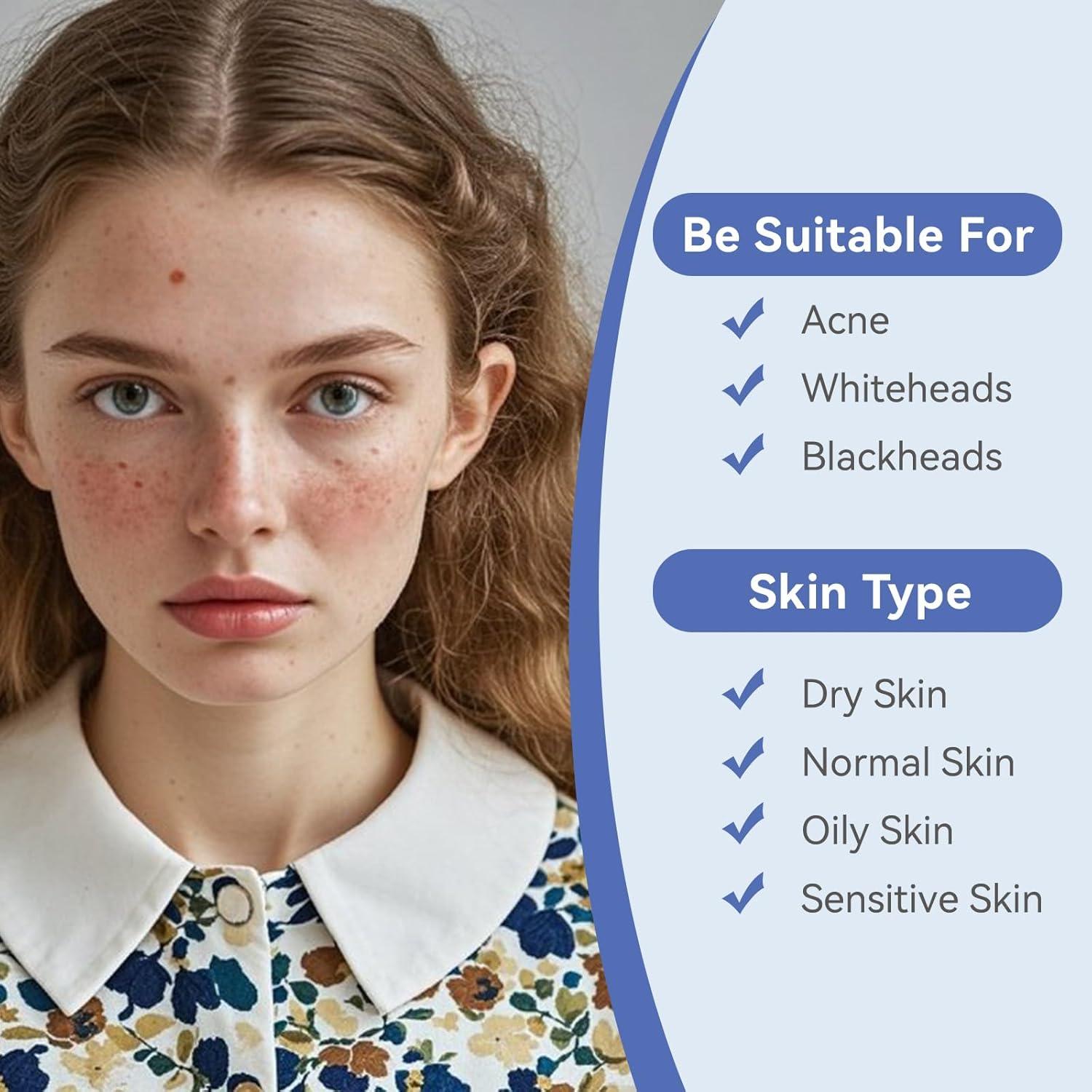 Parches Hidrocoloides para Granos Omadoto 12mm - 72 Unidades