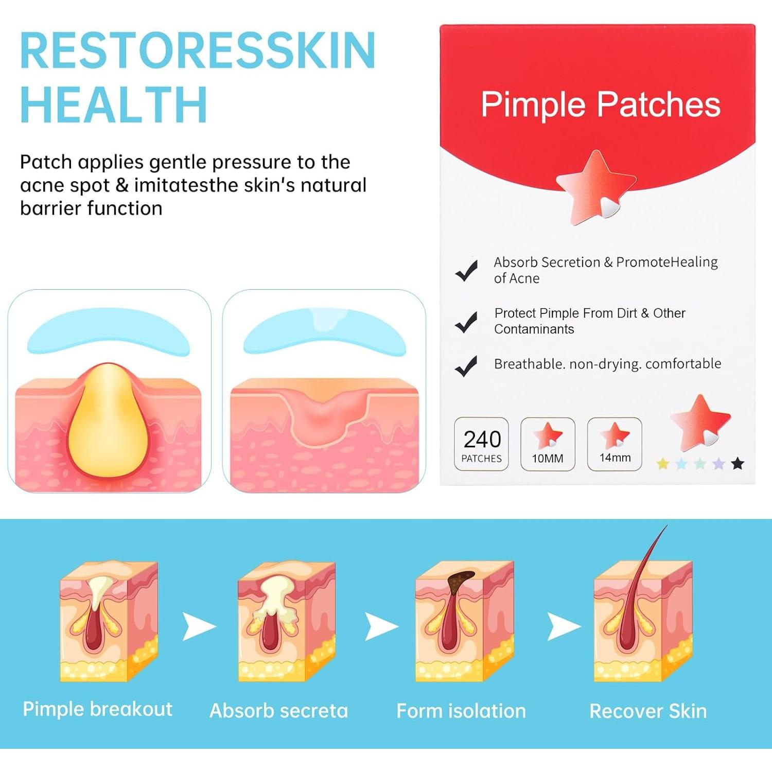 Parche para Granos Estrella Waspot - 240 Unidades Hidrocoloide