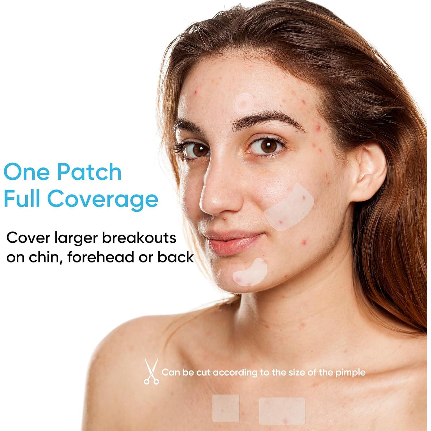 Parche para Acné Rulvcian - 18 Microdart + 16 Grandes