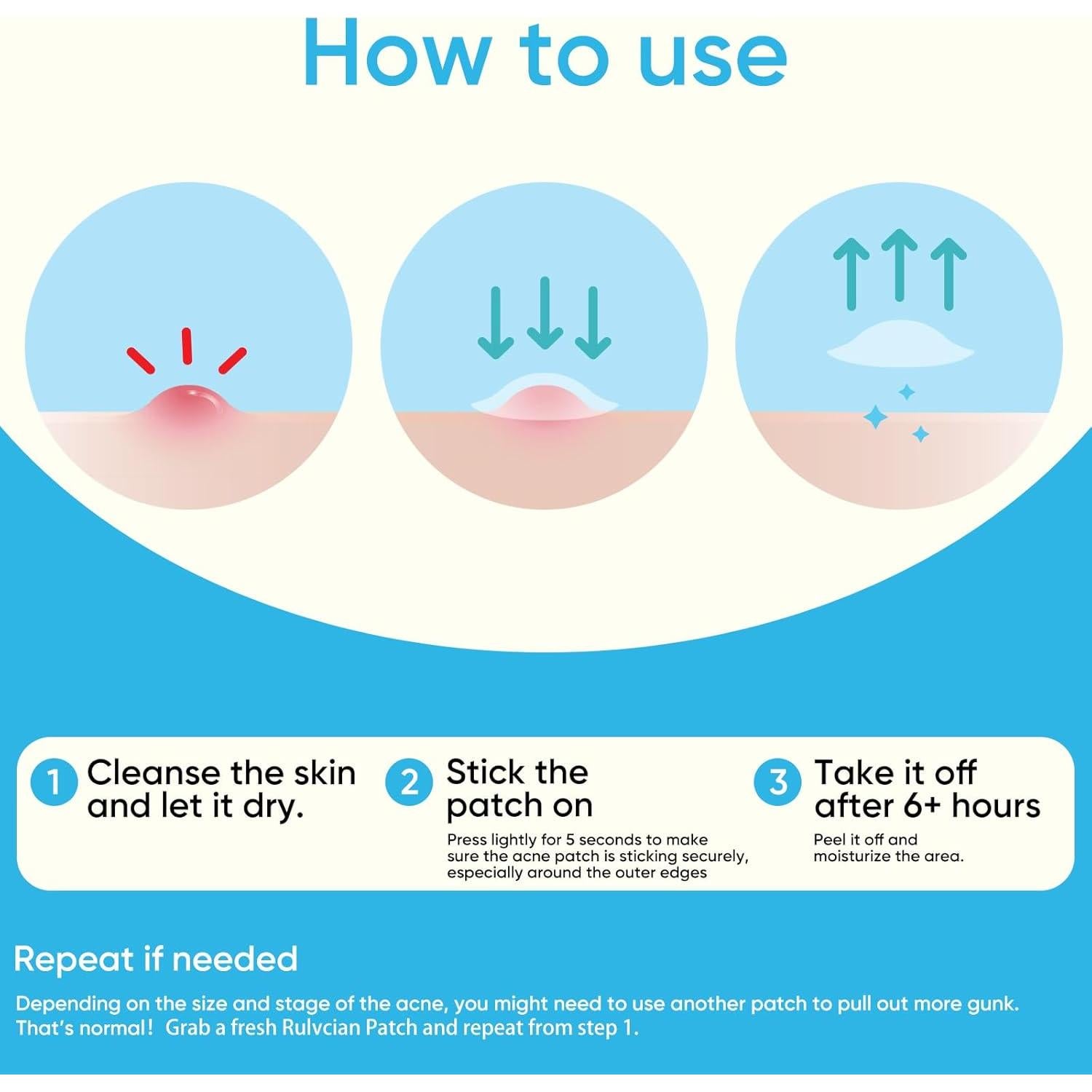 Parche para Acné Rulvcian - 18 Microdart + 16 Grandes