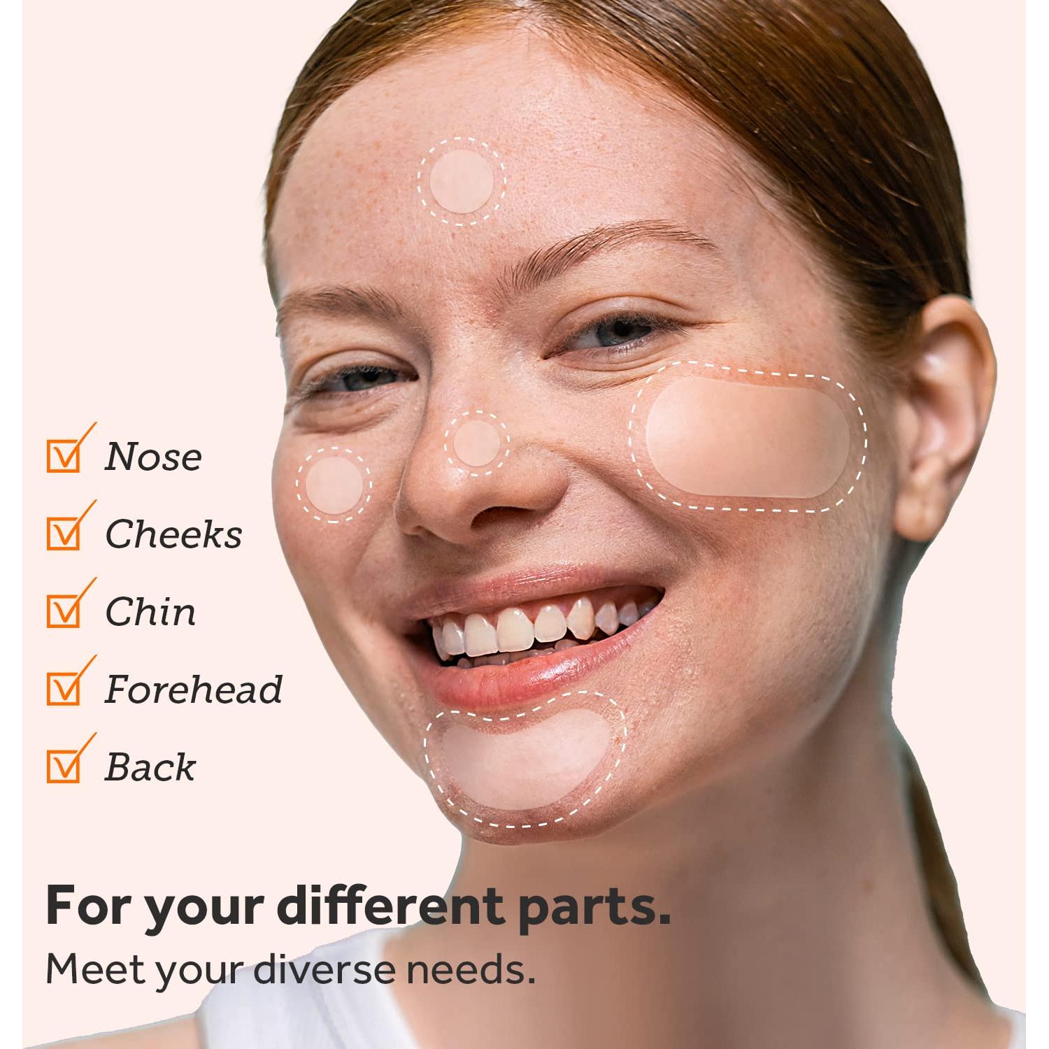 Parche para Granos ZATKTK - 138 Parches Hidrocoloide XL