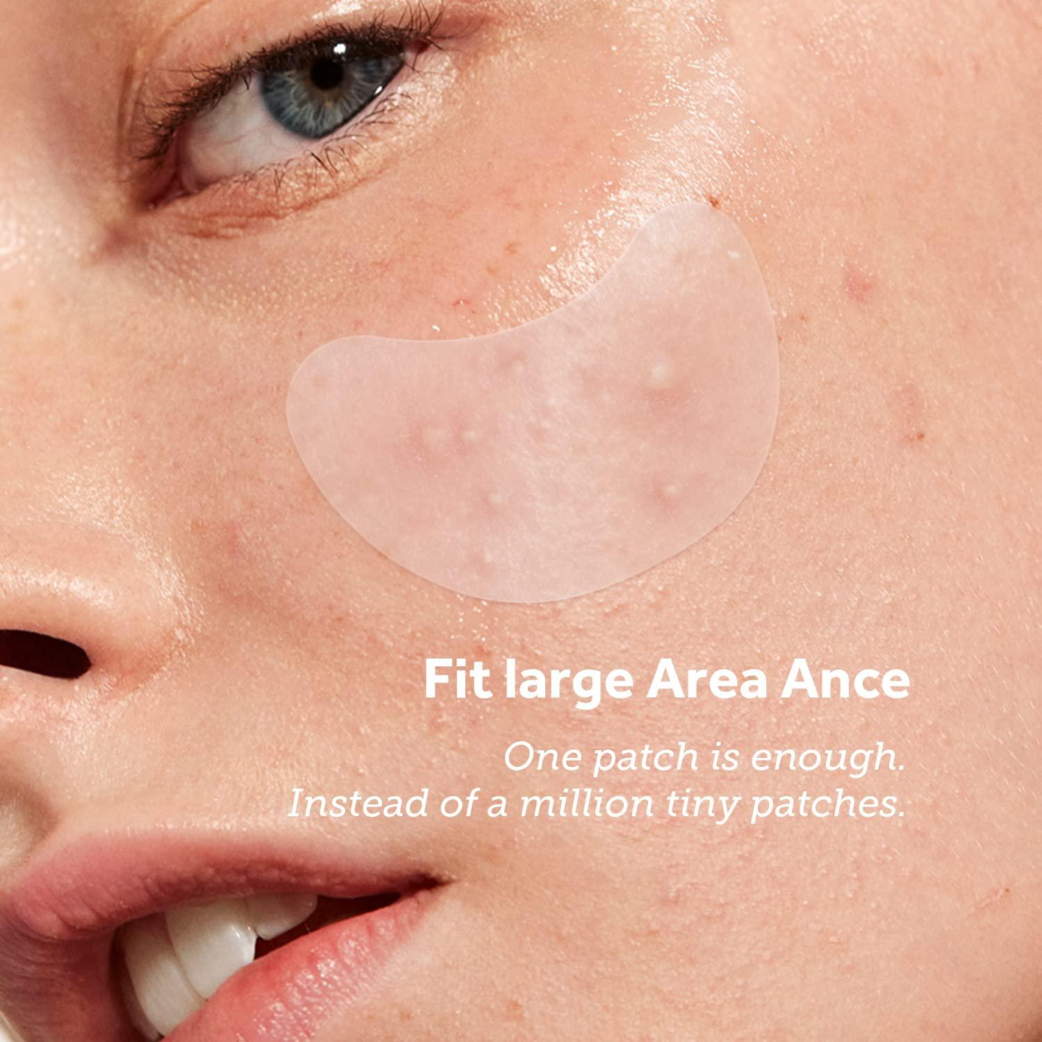 Parche para Granos ZATKTK - 138 Parches Hidrocoloide XL