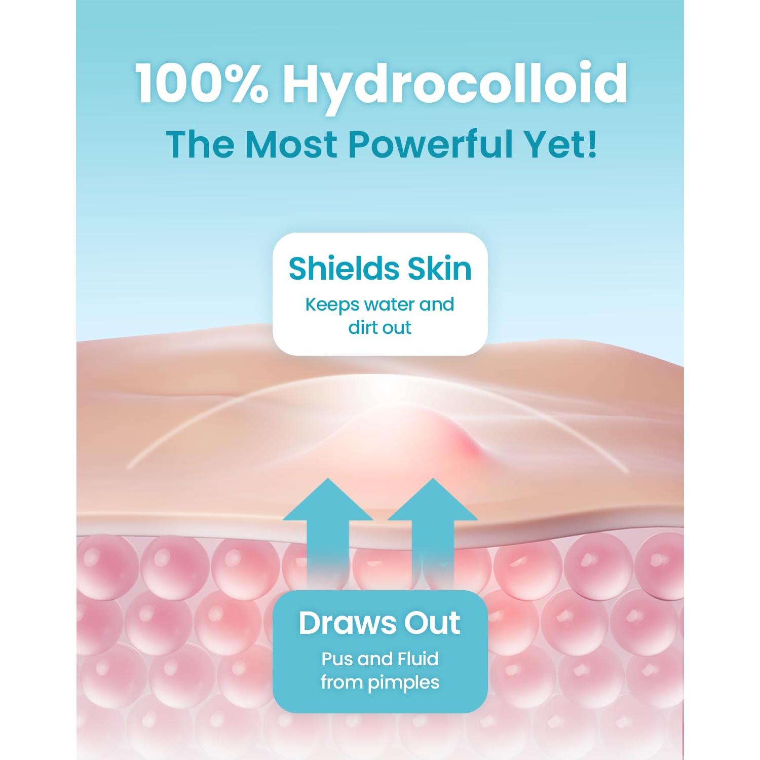 Parches Hidrocoloidales Glam Up 72 Unidades - Imperfecciones