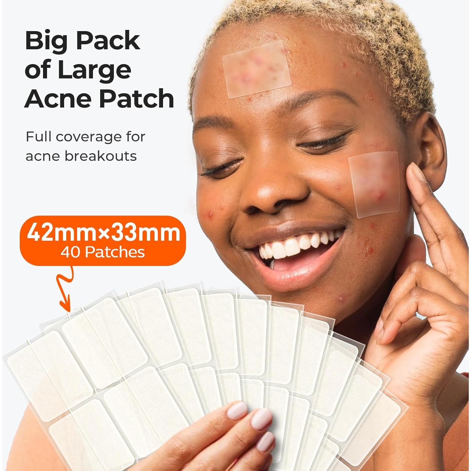 Parche para Granos TKTK Hidrocoloide 92 Parches 5 Tamaños