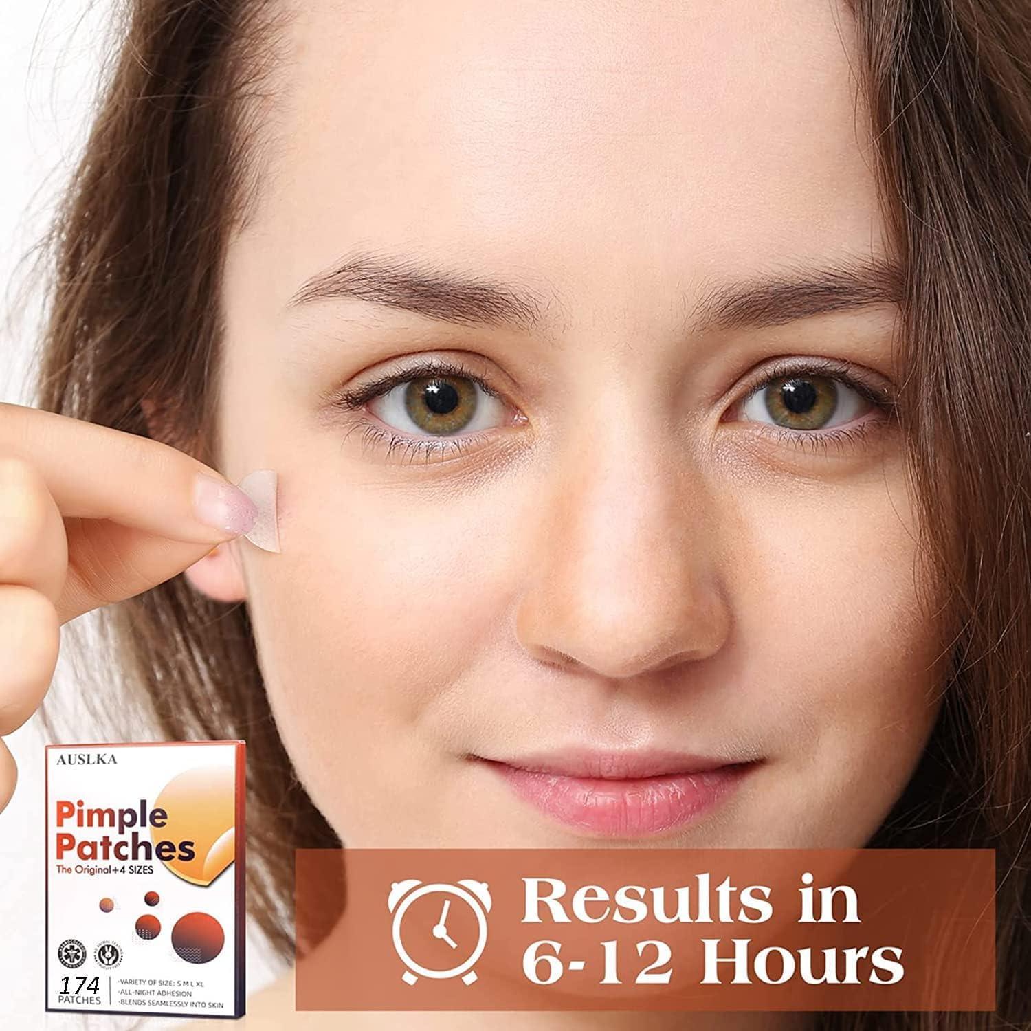 Parches Hidrocoloides para Imperfecciones AUSLKA - 175 Parches