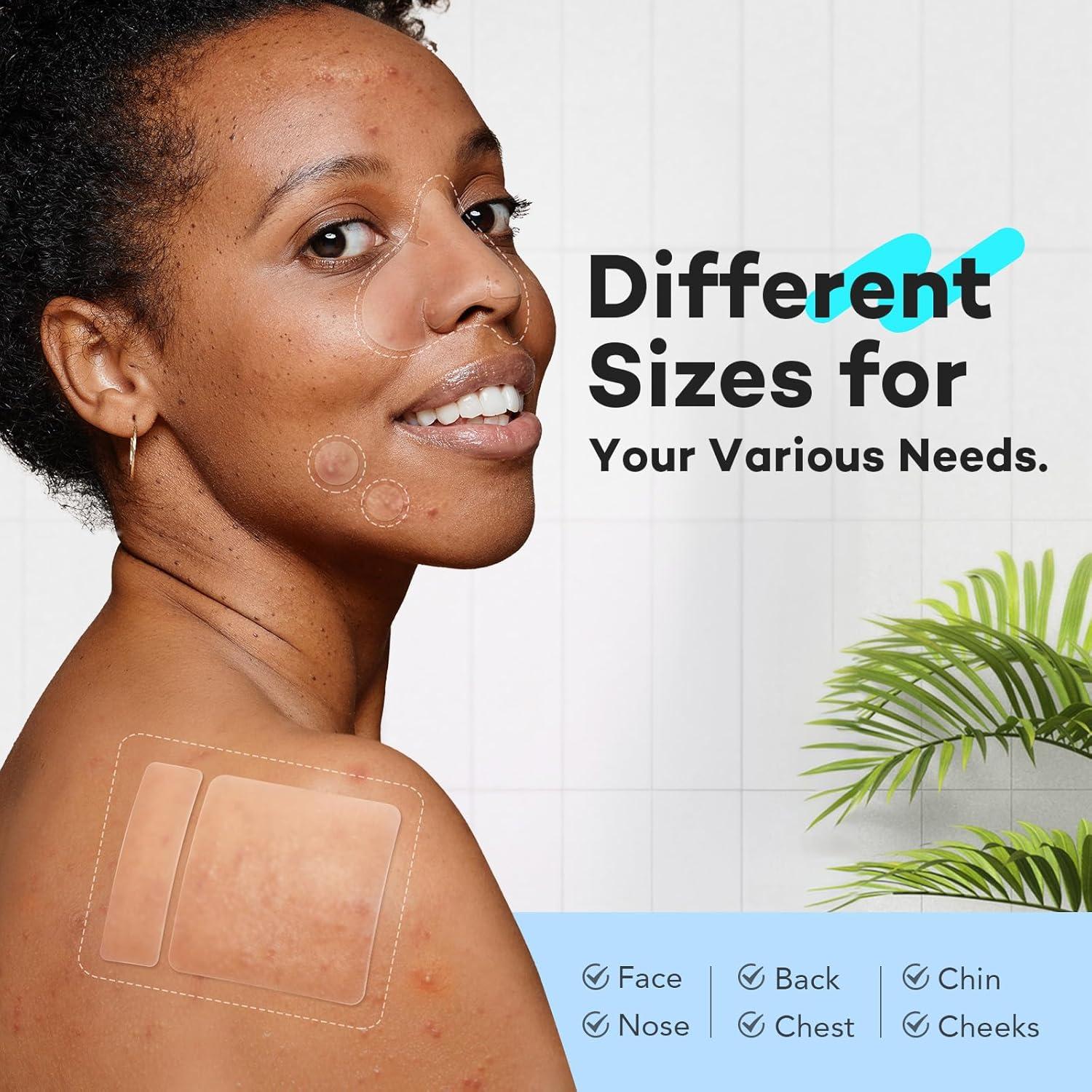 Parches para Granos LitBear - 118 Parches Hidrocoloide XL