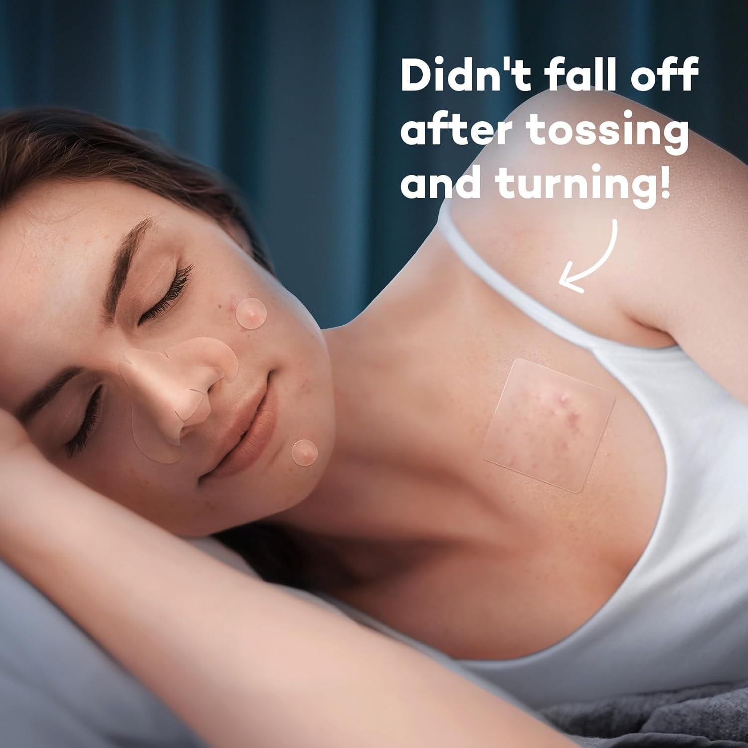 Parches para Granos LitBear - 118 Parches Hidrocoloide XL