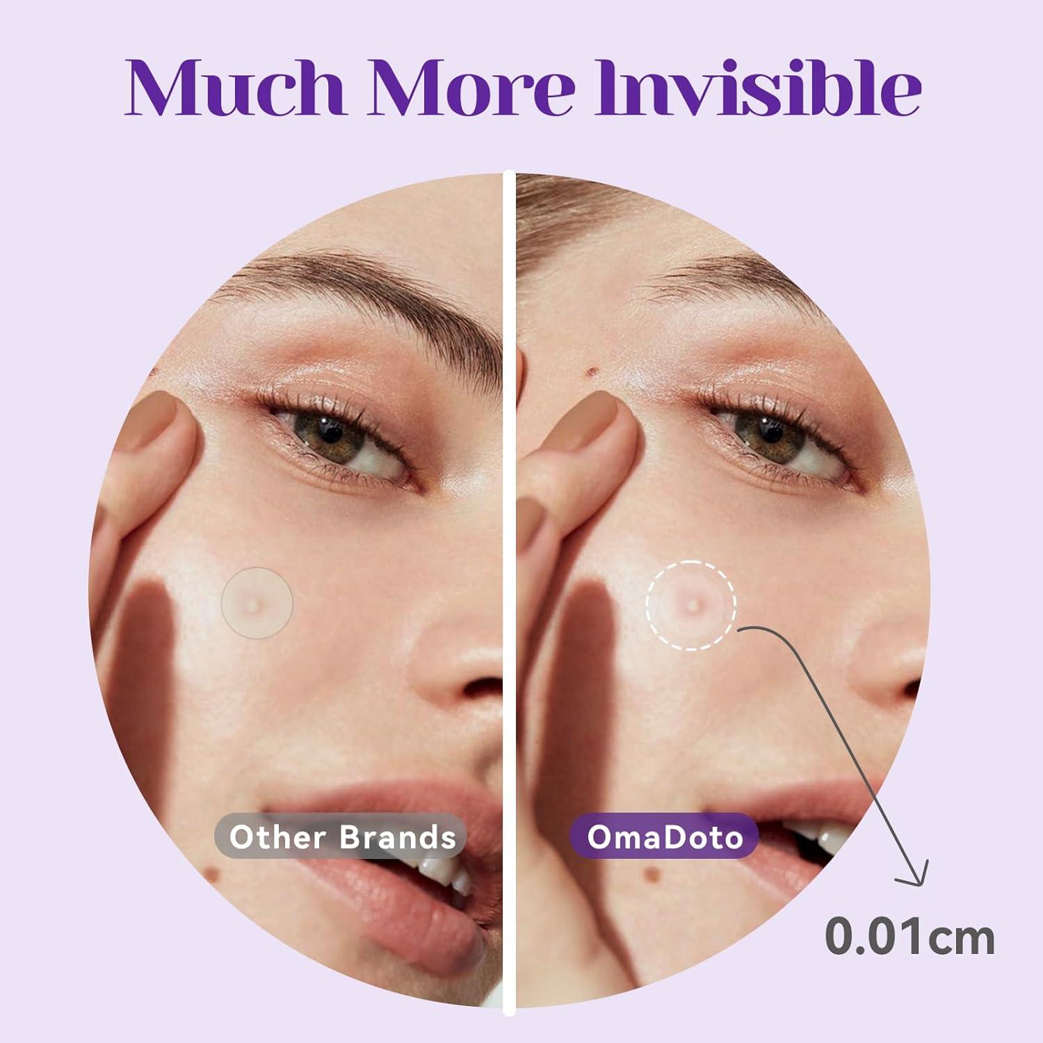 Parche Hidrocoloide para Granos Nocturno OmaDoto - 72 Piezas 10mm y 12mm