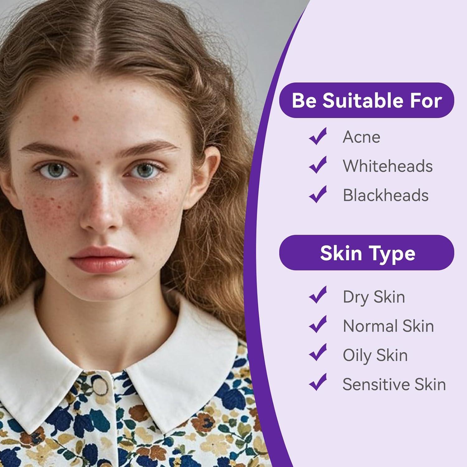 Parche Hidrocoloide para Granos Nocturno OmaDoto - 72 Piezas 10mm y 12mm