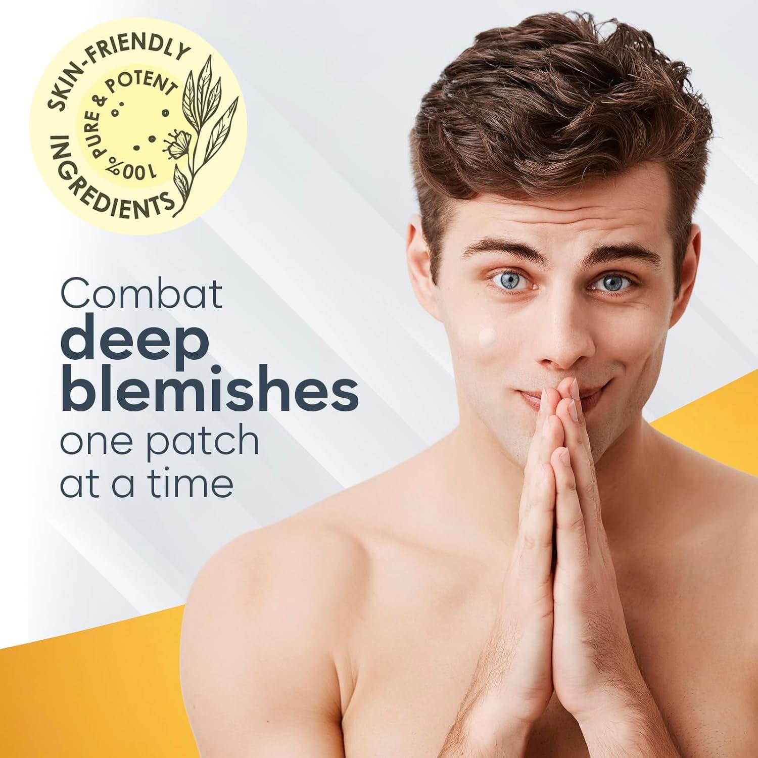 Parche Microdart para Acné Quístico Bloomora - 24 Parches