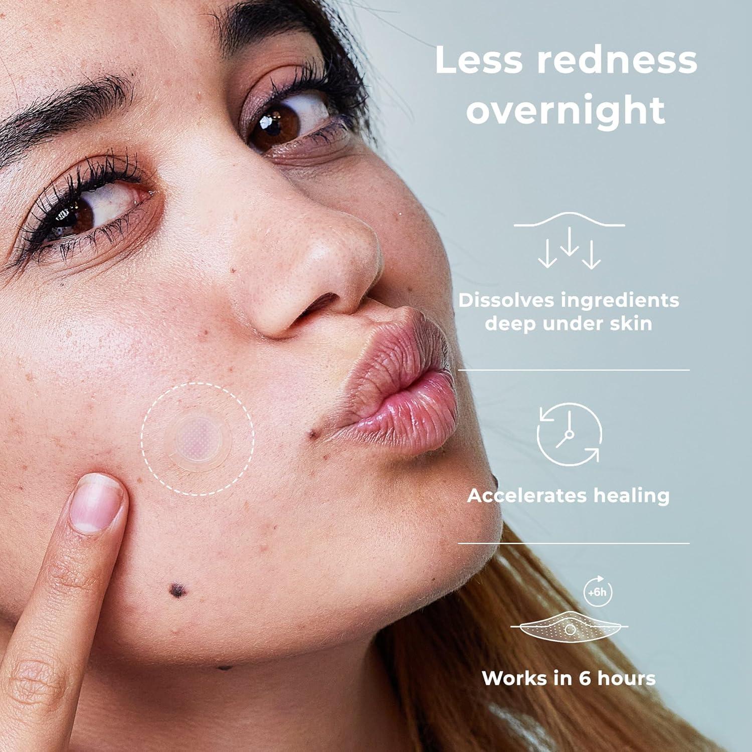 Parche de Acné Micropunto OMMA 14mm - Tratamiento Rápido