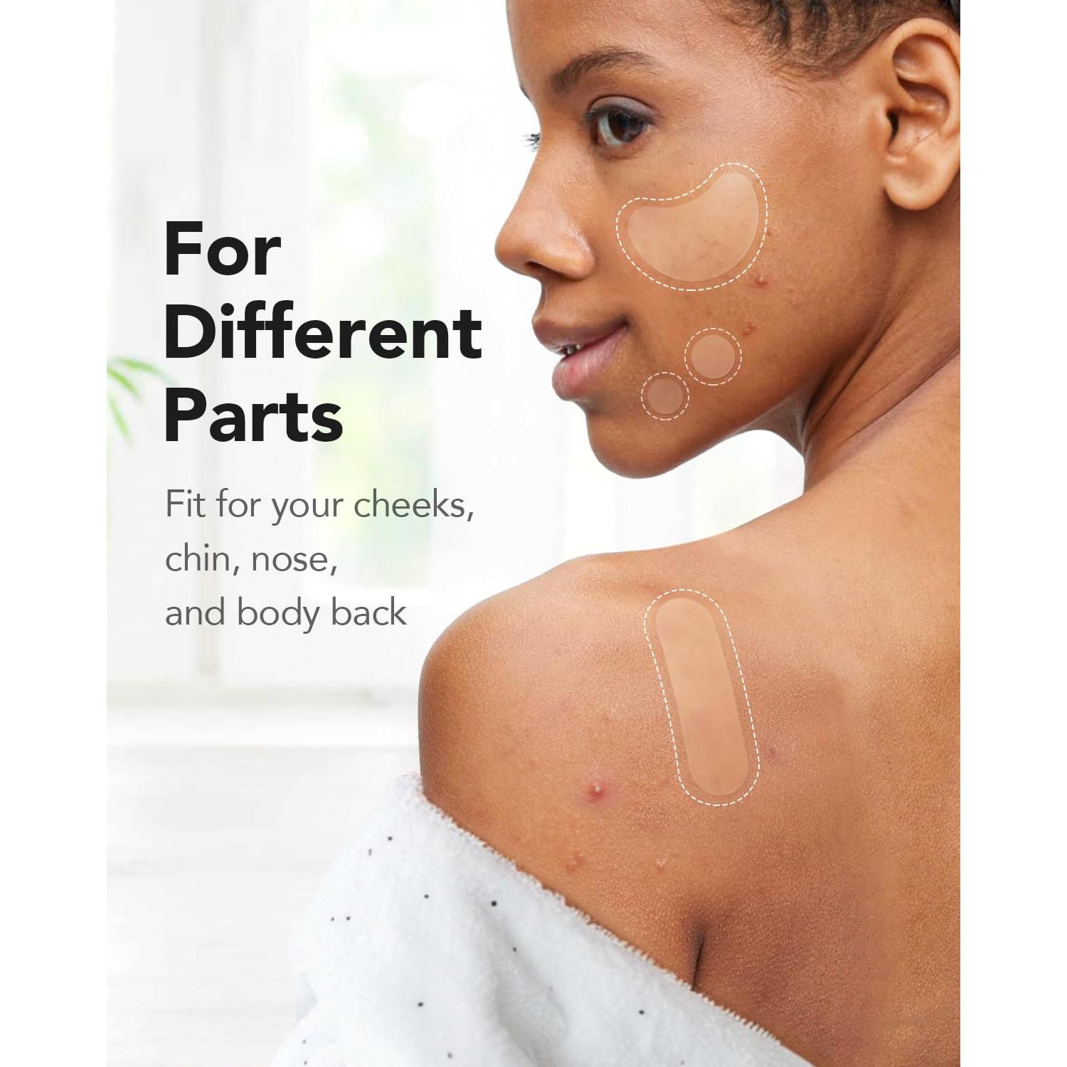 Parches Hidrocoloides para Acné LitBear - 140 Pcs, 8 Tamaños