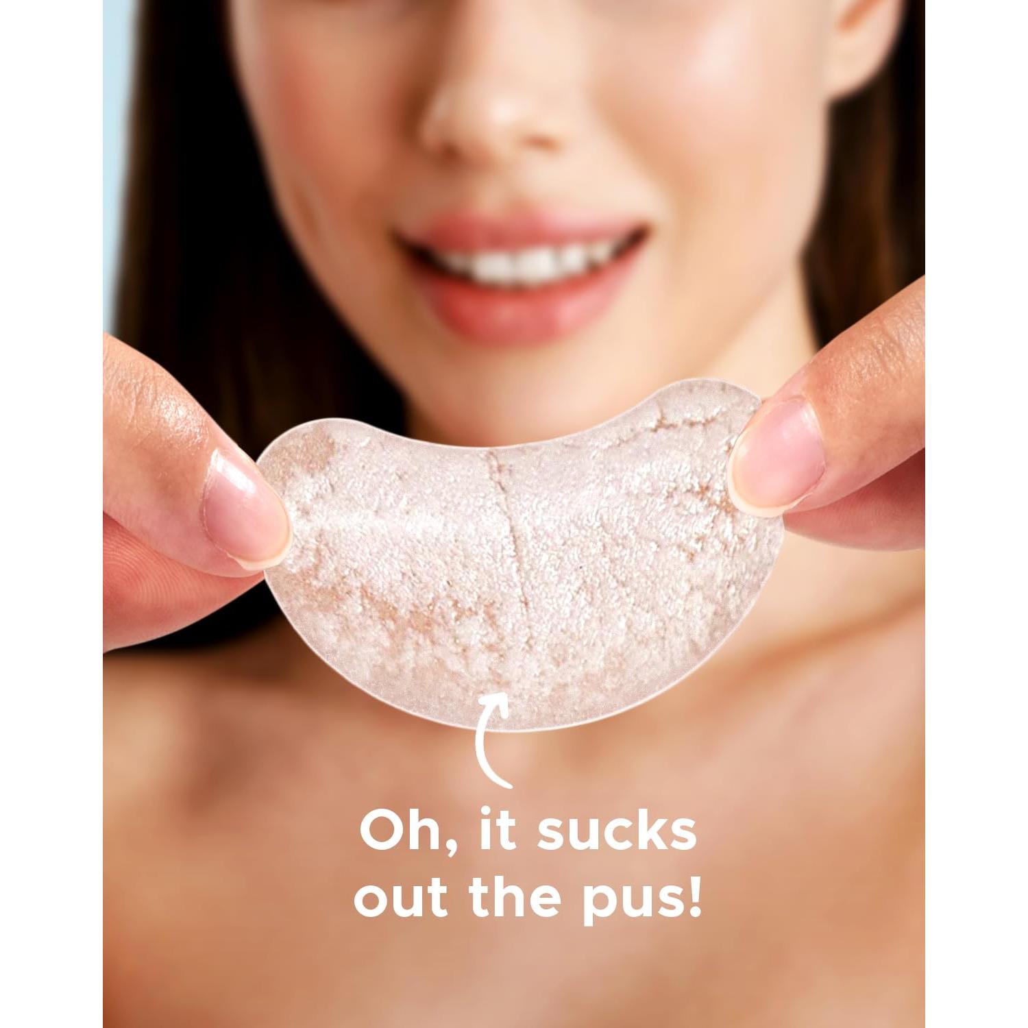 Parches Hidrocoloides para Acné LitBear - 140 Pcs, 8 Tamaños