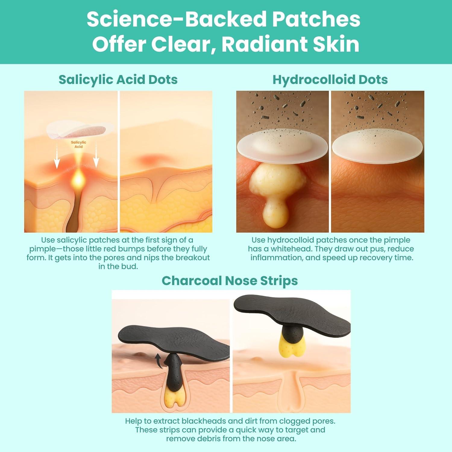Kit de Tratamiento de Acné Patchology Breakout Box 3-en-1