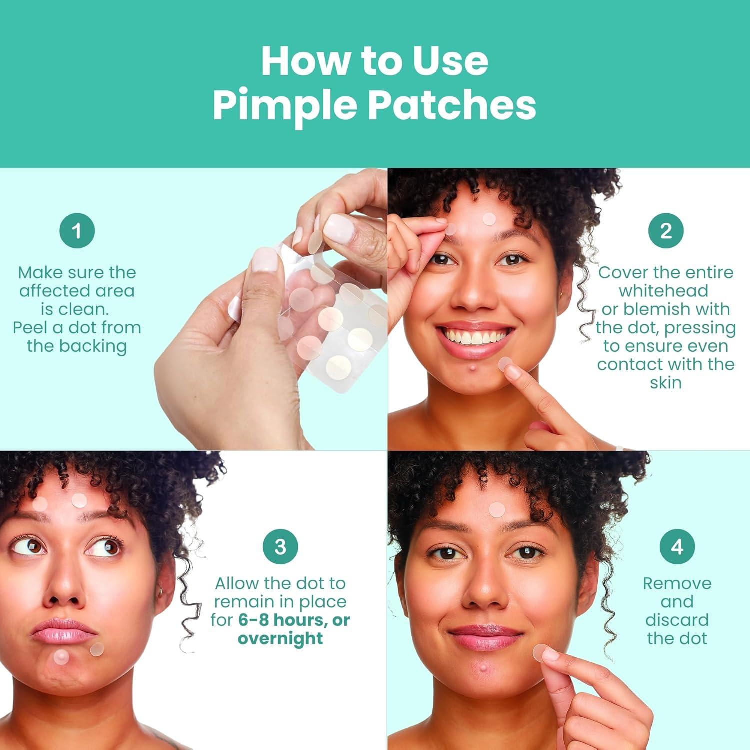 Kit de Tratamiento de Acné Patchology Breakout Box 3-en-1