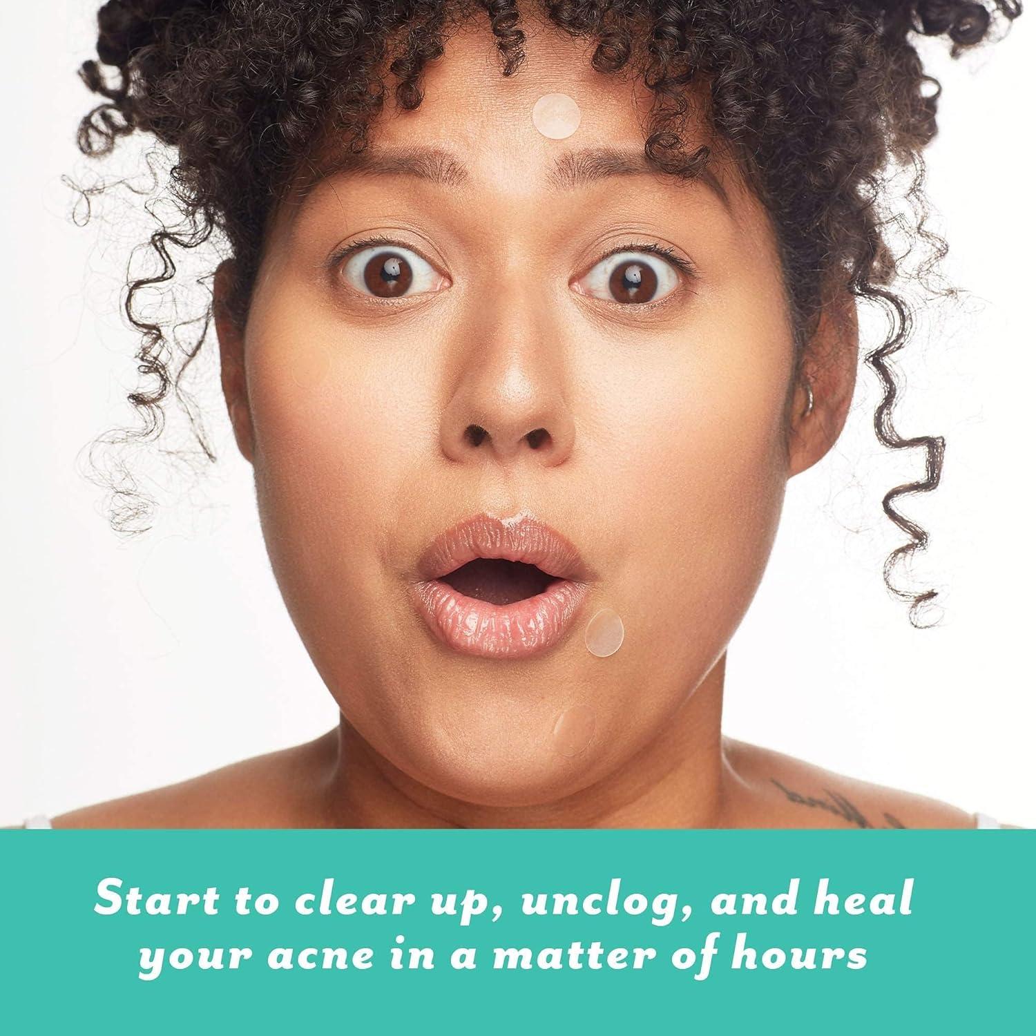 Kit de Tratamiento de Acné Patchology Breakout Box 3-en-1