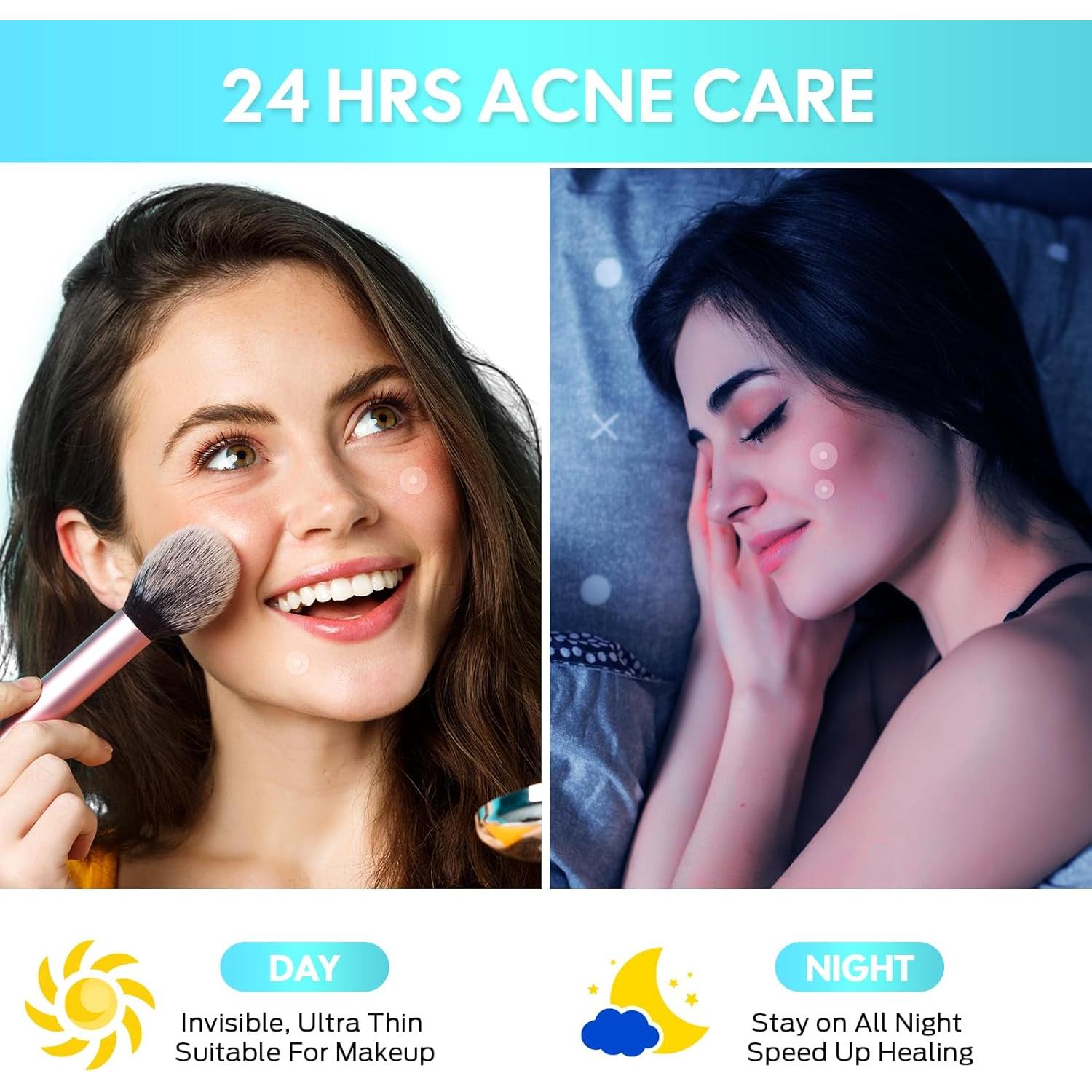 Parche Hidrocoloide para Granos VivaciousVision 306 Unidades