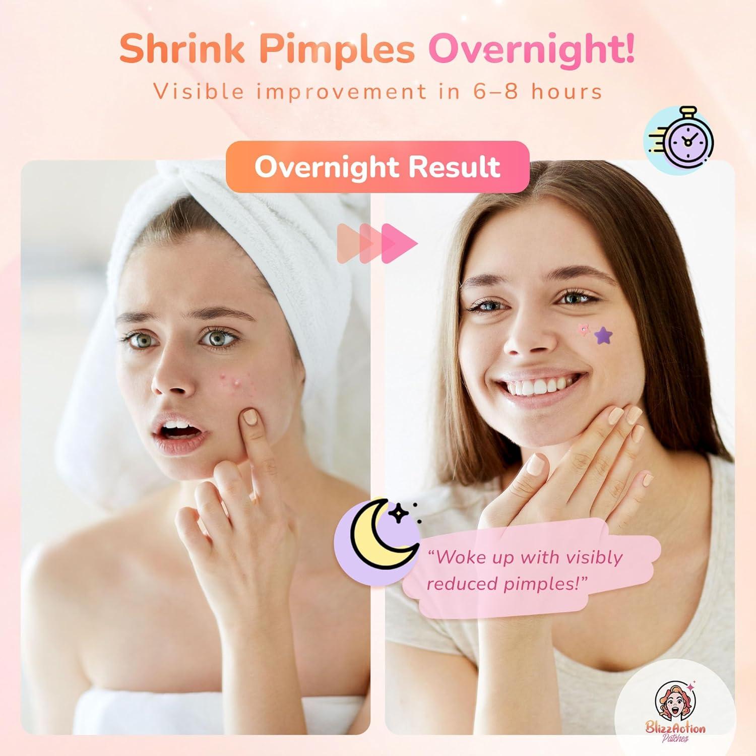 Parches para Espinillas BlizzAction 237 Pcs Hidrocoloides