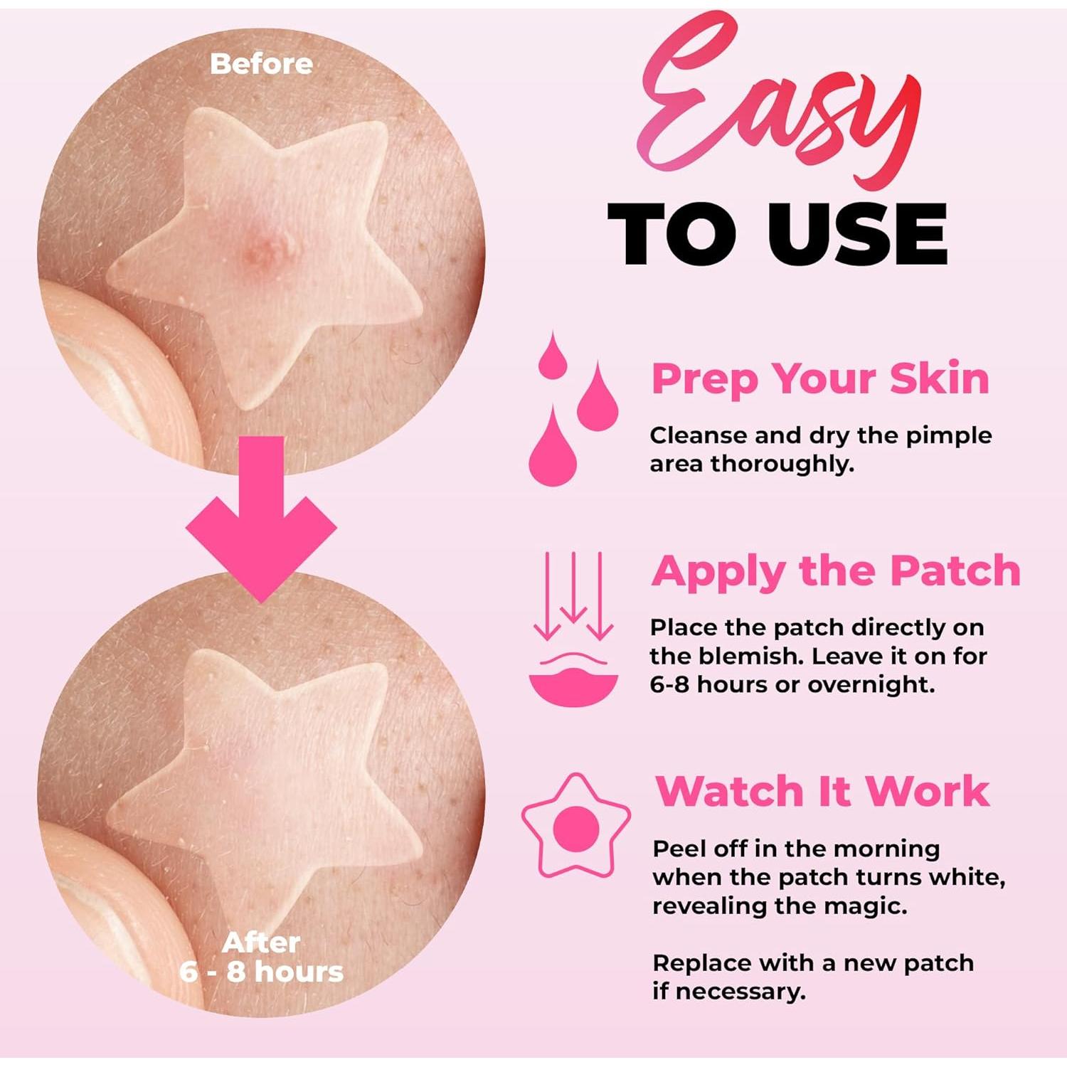 260 Parches Hidrocoloides para Espinillas Andlane - 7 Colores y 2 Tamaños