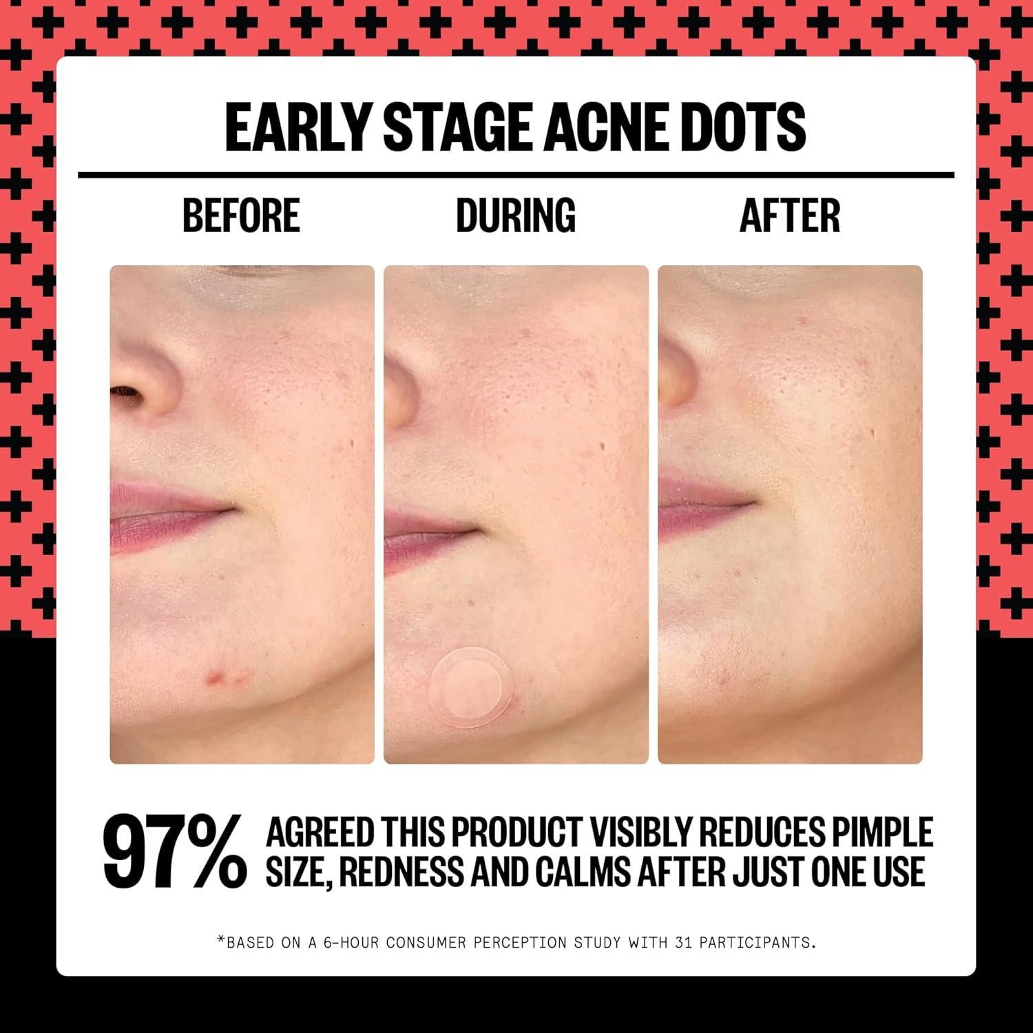 Parches para Acné PEACE OUT - 8 Unidades con Ácido Salicílico