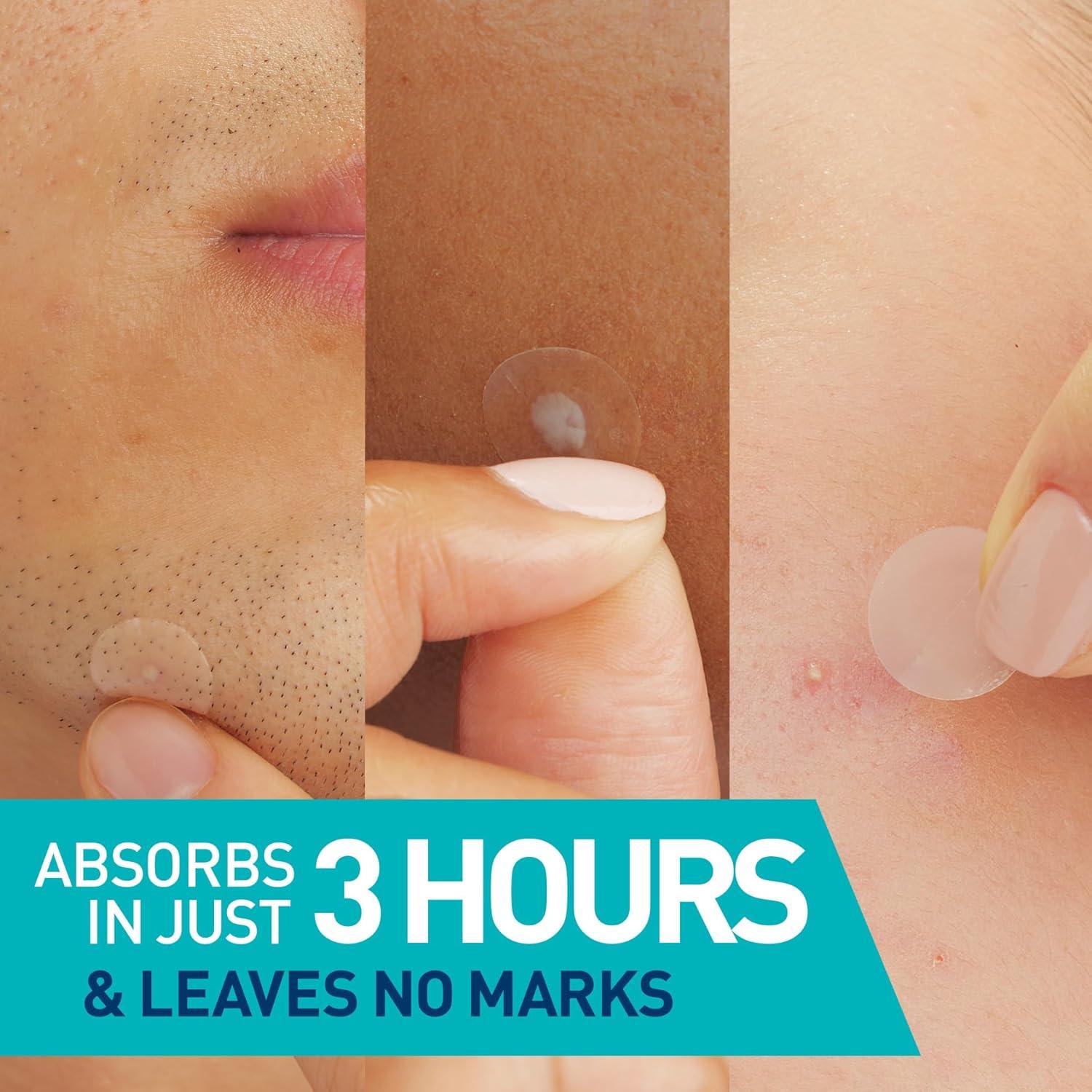 Parches Hidrocoloides CeraVe para Imperfecciones 22ct