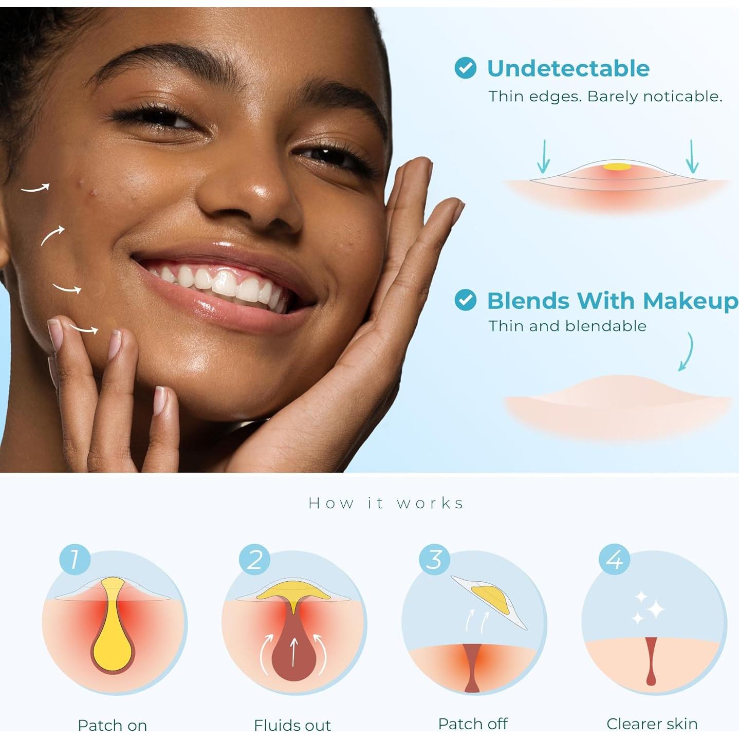 Parche Hidrocoloide para Acné CLEOF - 46 Unidades Vegano