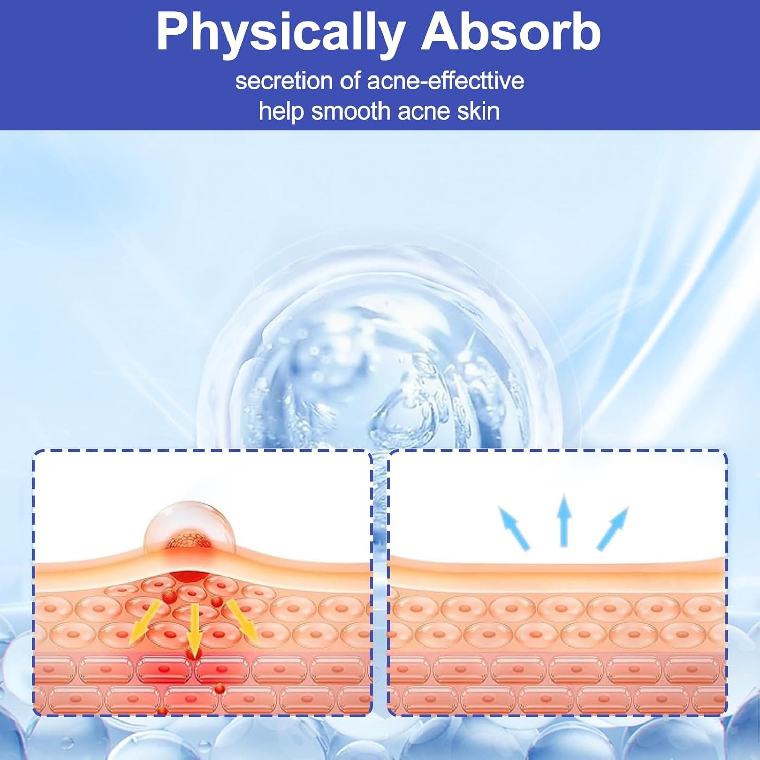 Parche Hidrocoloide para Granos CACRTY - 288 Piezas, Aceite de Árbol de Té