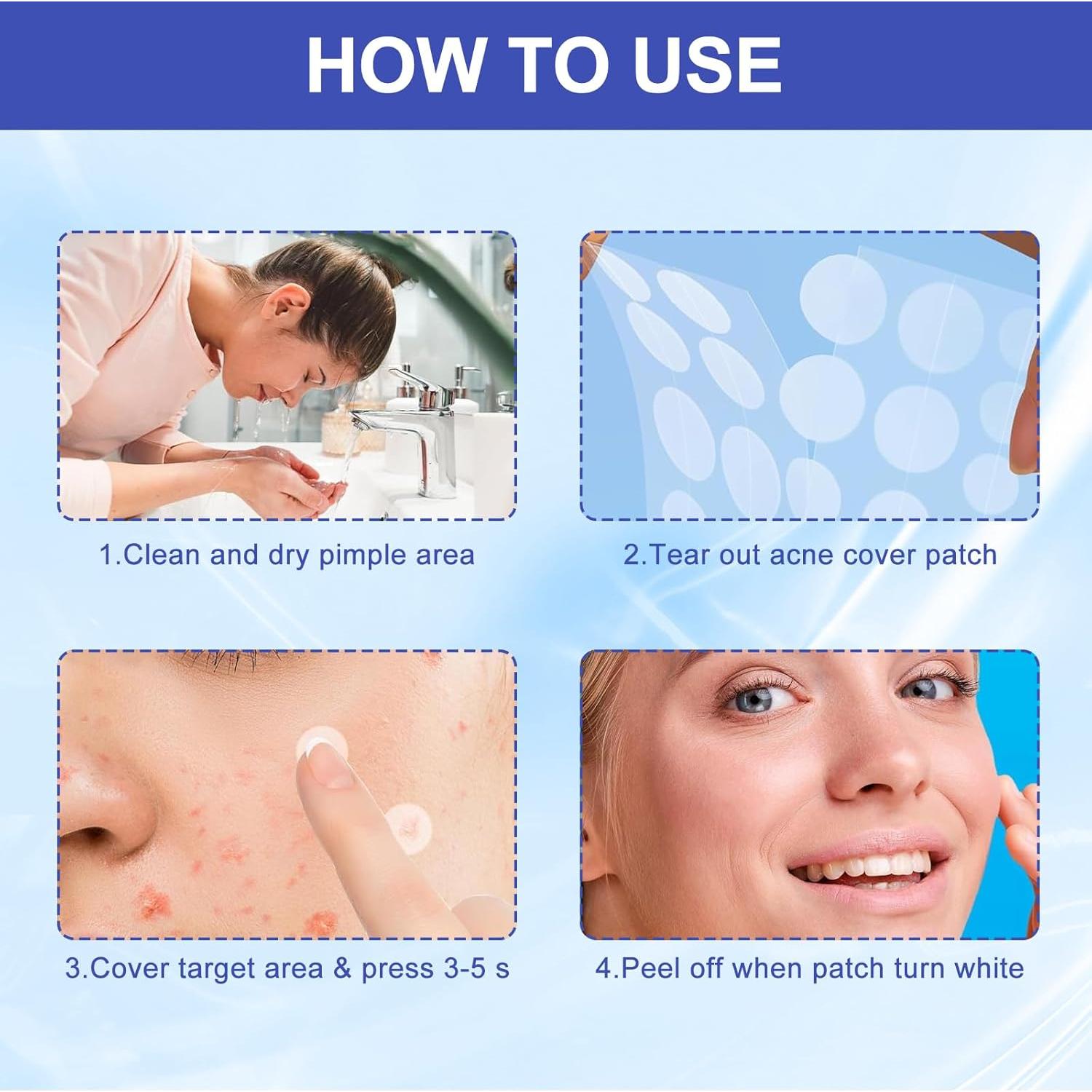 Parche Hidrocoloide para Granos CACRTY - 288 Piezas, Aceite de Árbol de Té