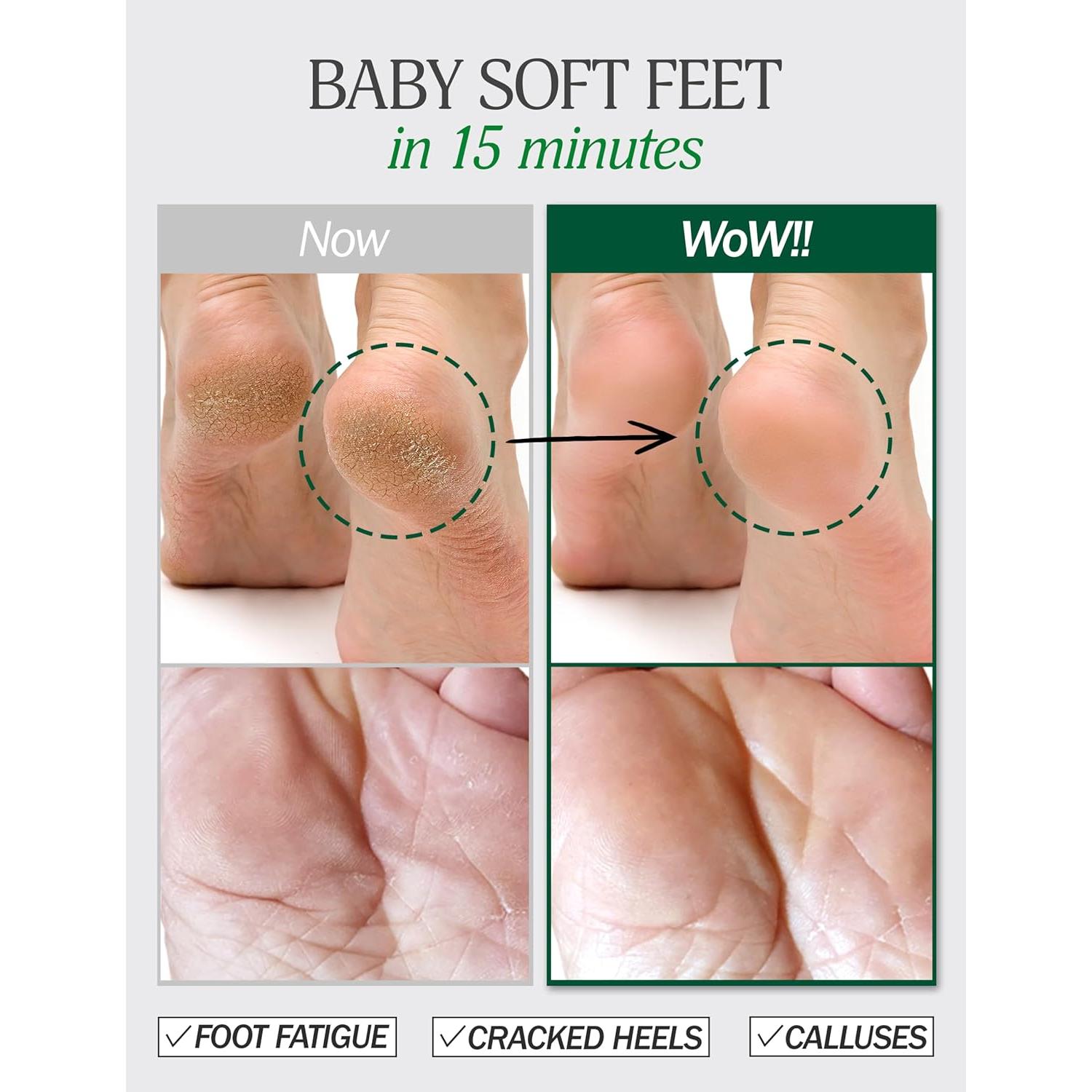 Mascarilla Hidratante para Pies Secos y Agrietados TODAYDAY - 5 Pares