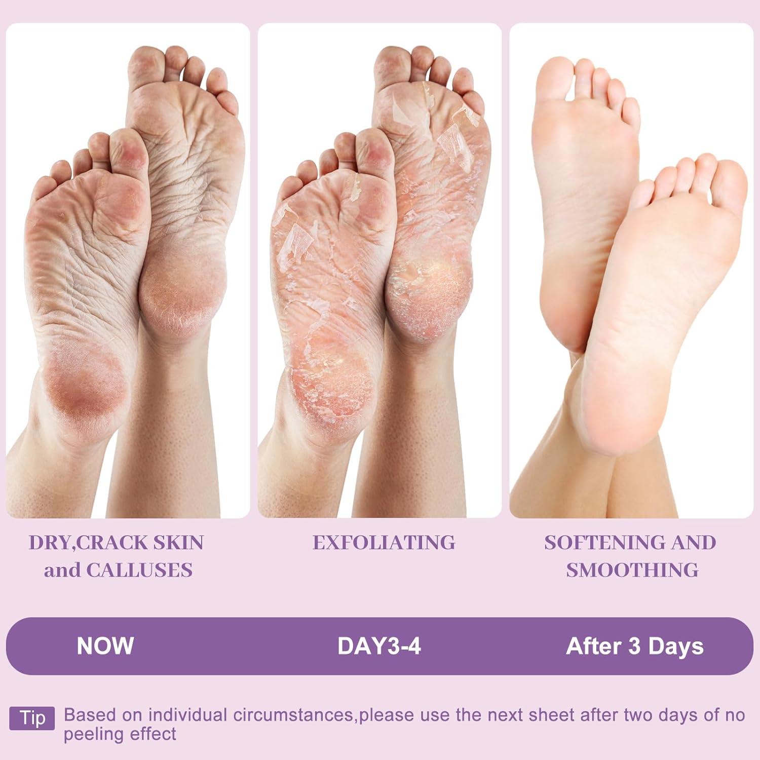 Máscara Exfoliante para Pies Berlaney - 3 Pares con Lavanda