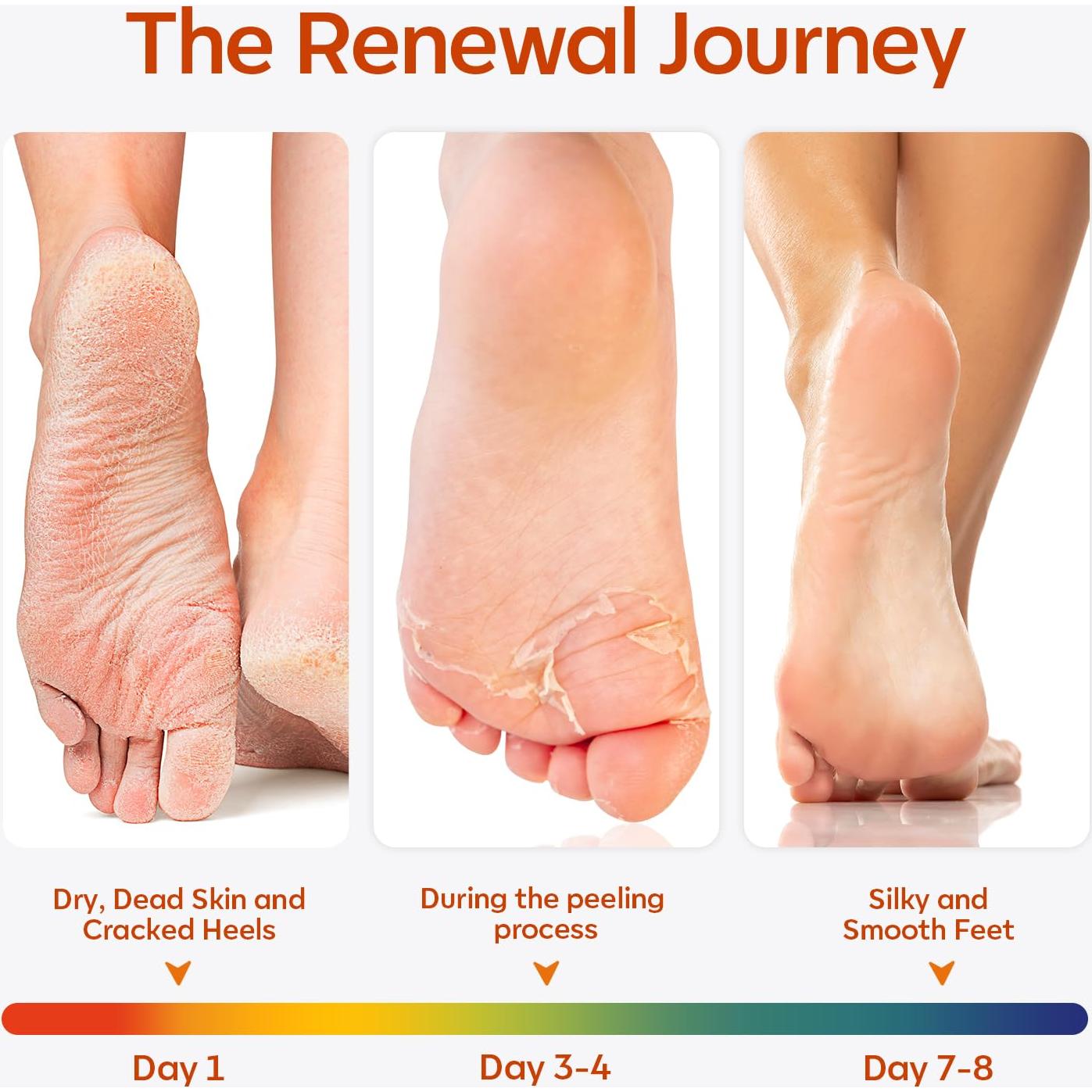 Mascarilla Exfoliante para Pies Modelones - 3 Paquetes con Colágeno