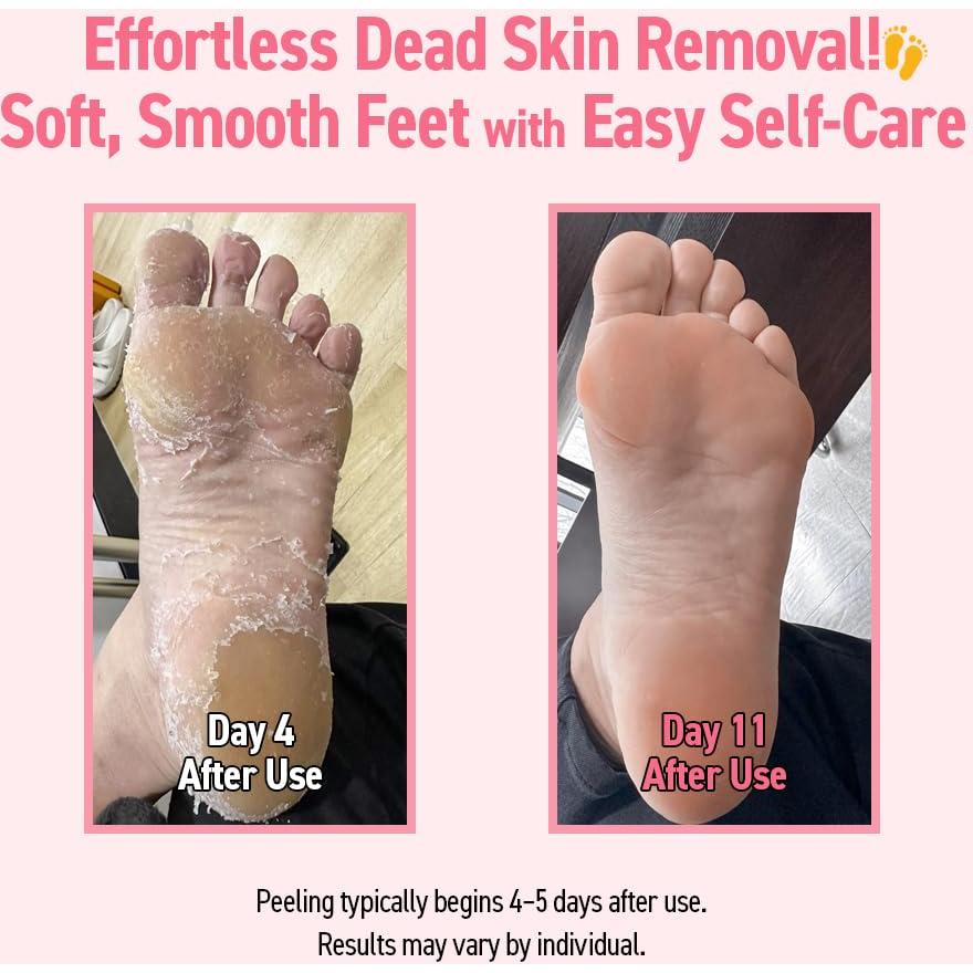 Mascarilla Exfoliante para Pies FRMADCOS - 2 Pares