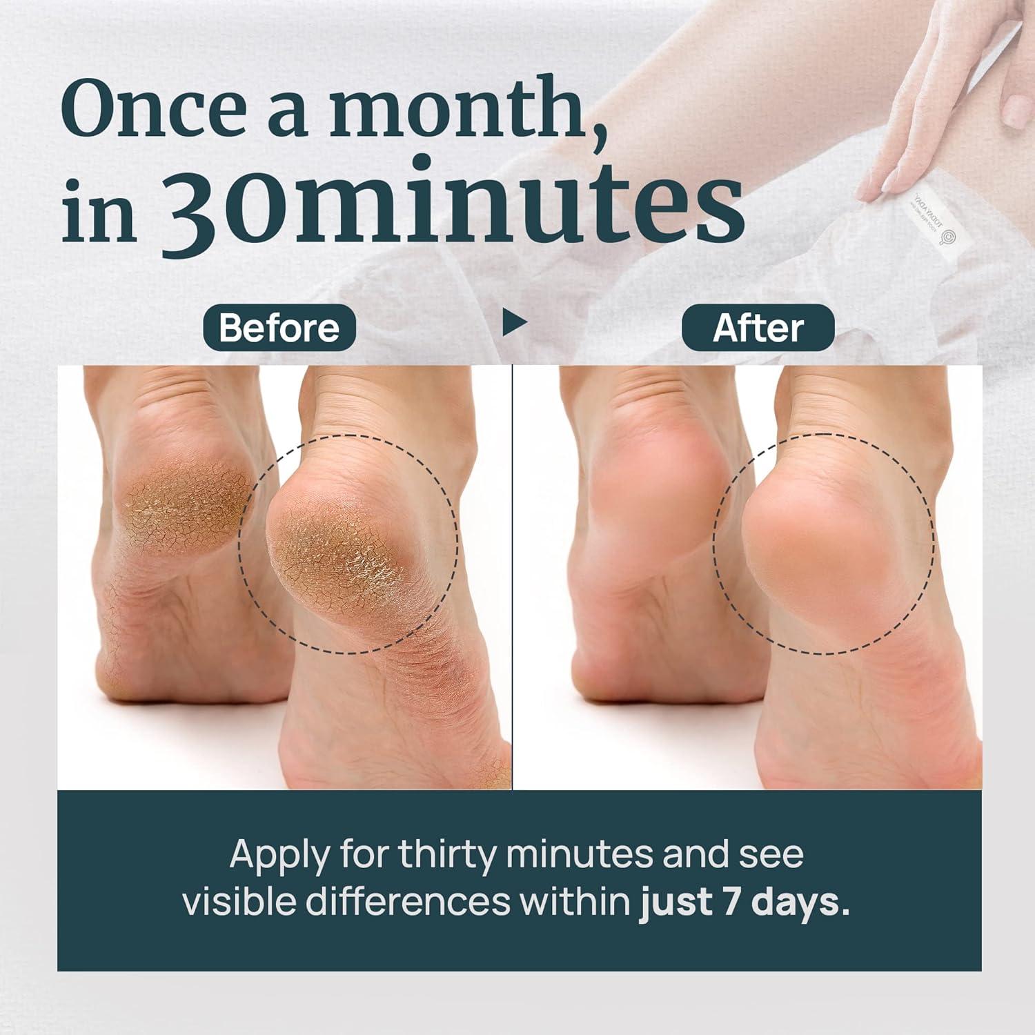 Mascarilla Exfoliante para Pies TODAYADAY - 3 Pares Hidratantes