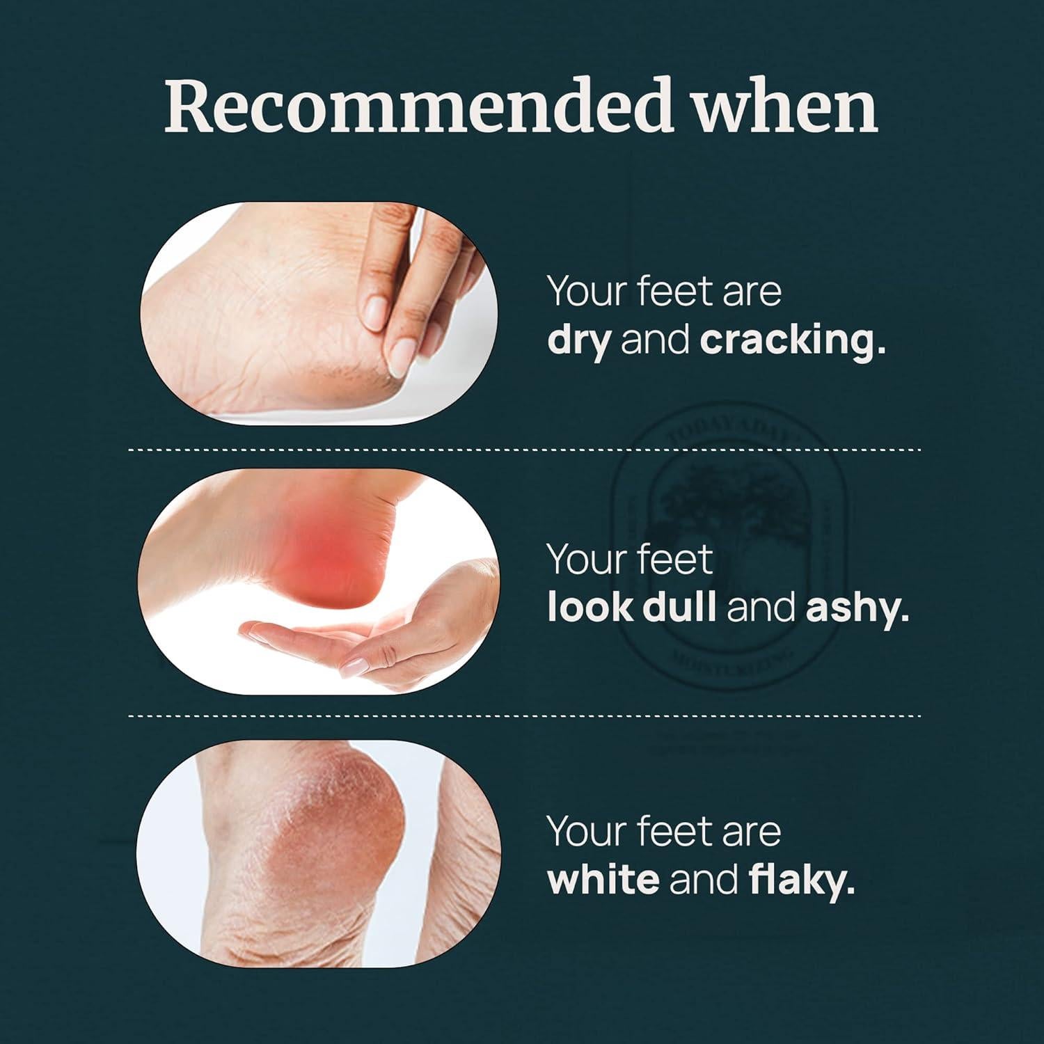 Mascarilla Exfoliante para Pies TODAYADAY - 3 Pares Hidratantes