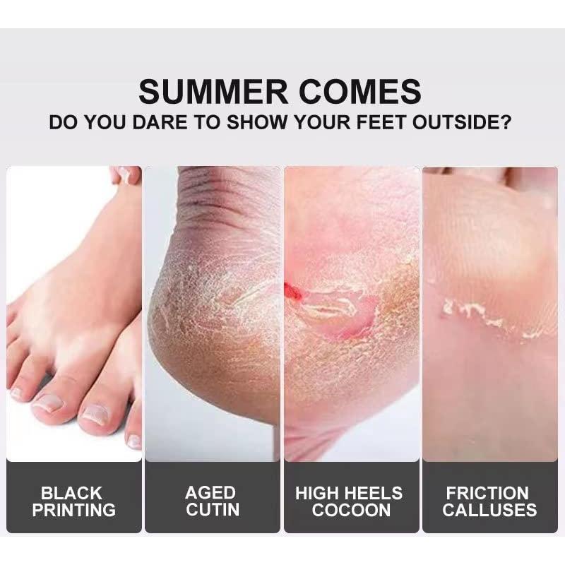 Mascarilla Exfoliante para Pies MaerWaw 6 Paquetes Lavanda