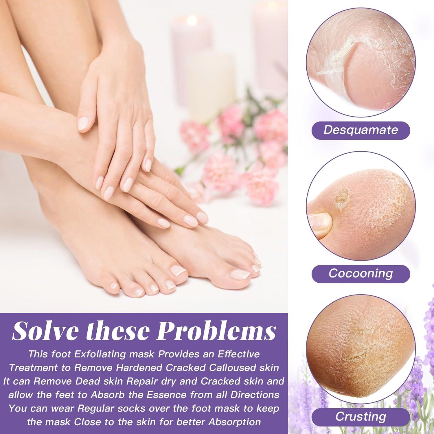 Mascarilla Exfoliante para Pies TOEDO - 5 Pares Hidratantes