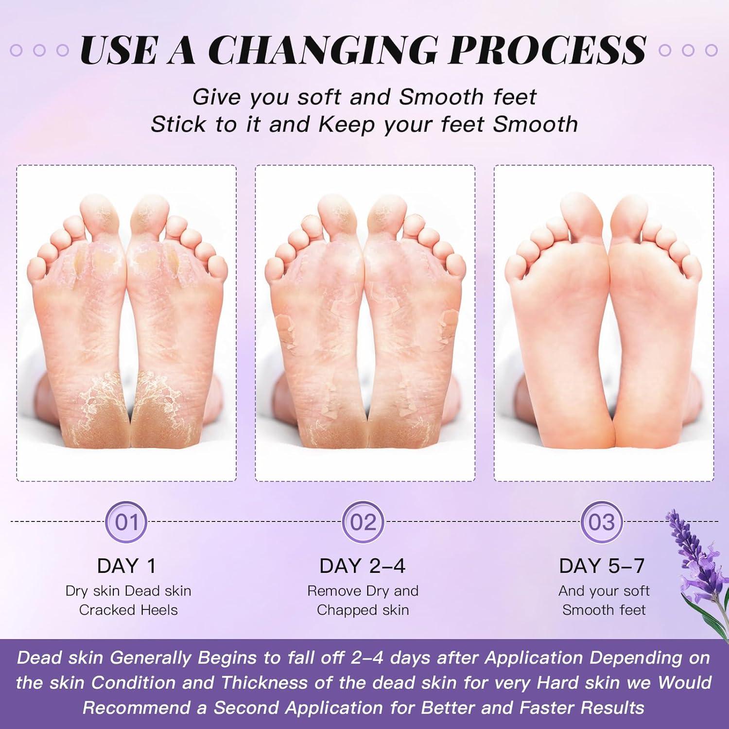 Mascarilla Exfoliante para Pies TOEDO - 5 Pares Hidratantes