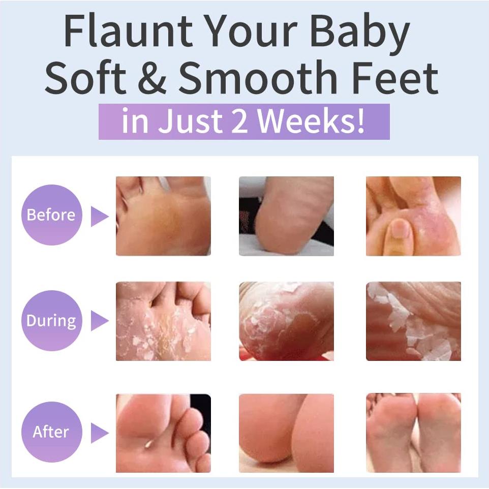 Set de 6 Mascarillas Exfoliantes para Pies y Manos YLady