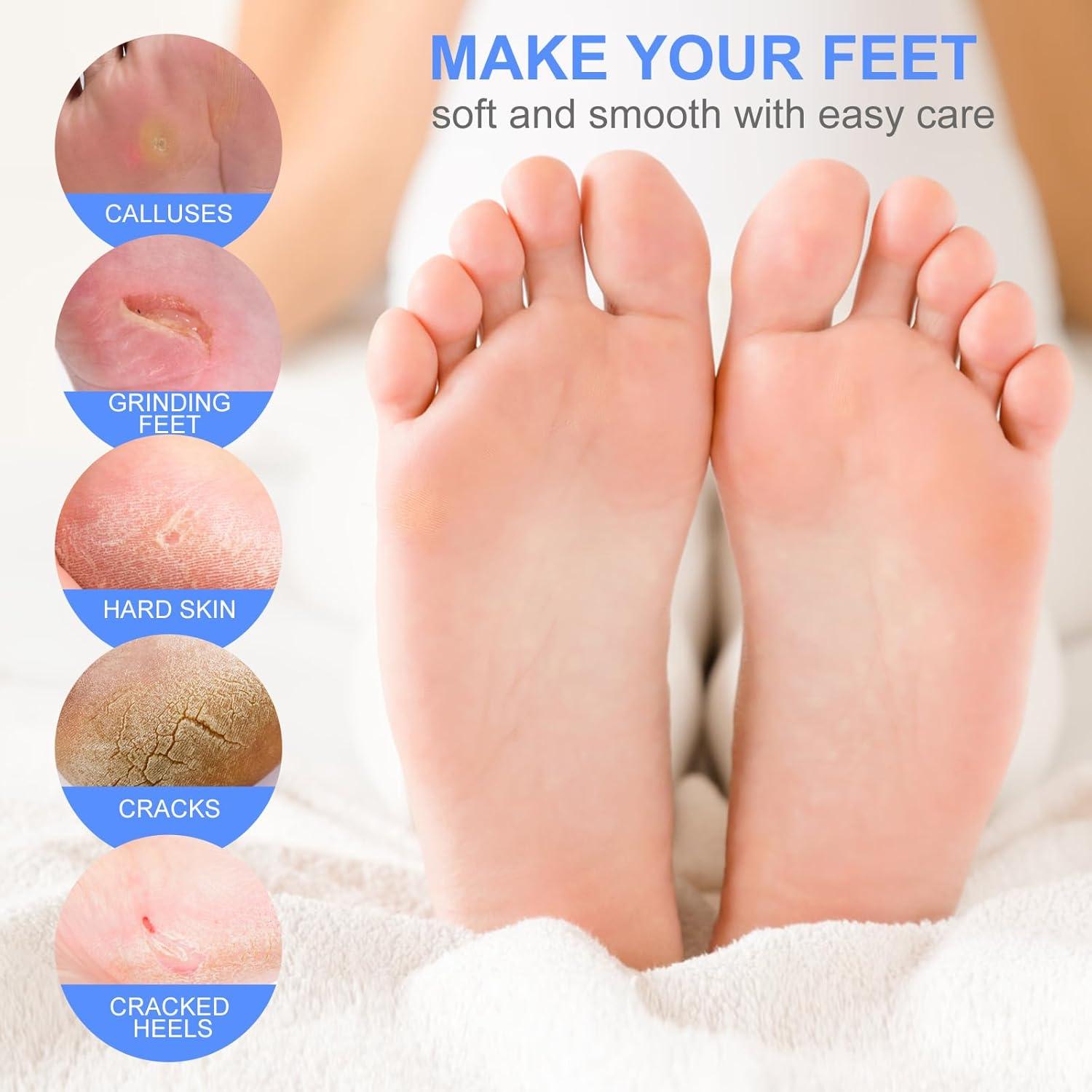 5 Paquetes Máscara Exfoliante para Pies VZZNN - Pies Suaves