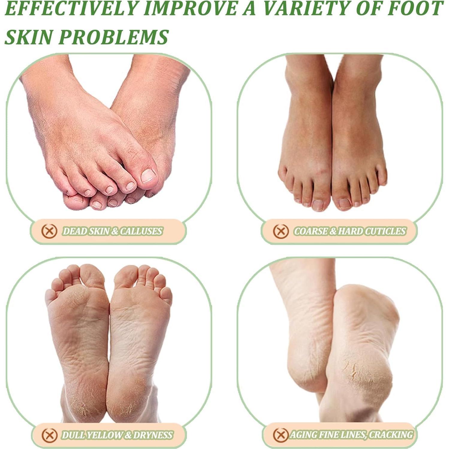 Paquete de 3 Mascarillas Exfoliantes para Pies CGBOOM - Árbol de Té