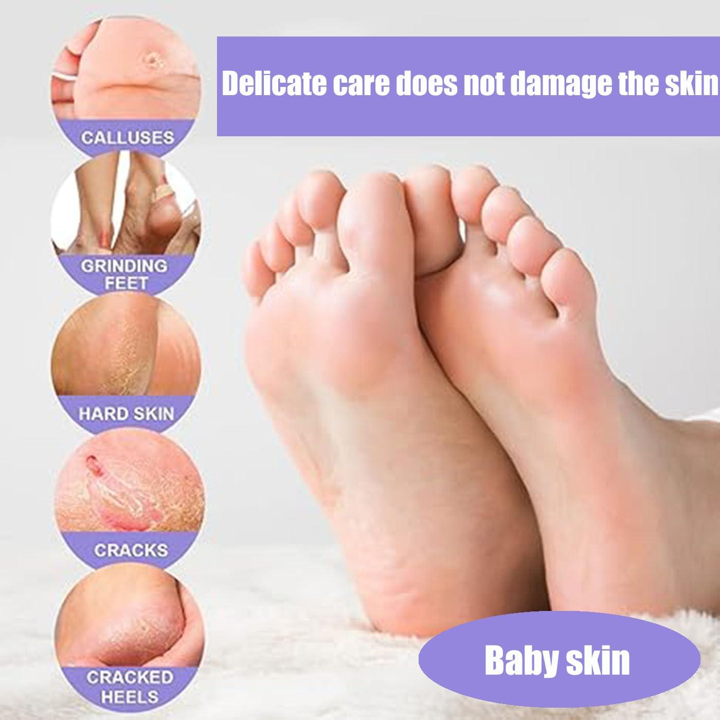 Mascarilla Exfoliante para Pies Mckkymi - 5 Paquetes Aroma Lavanda