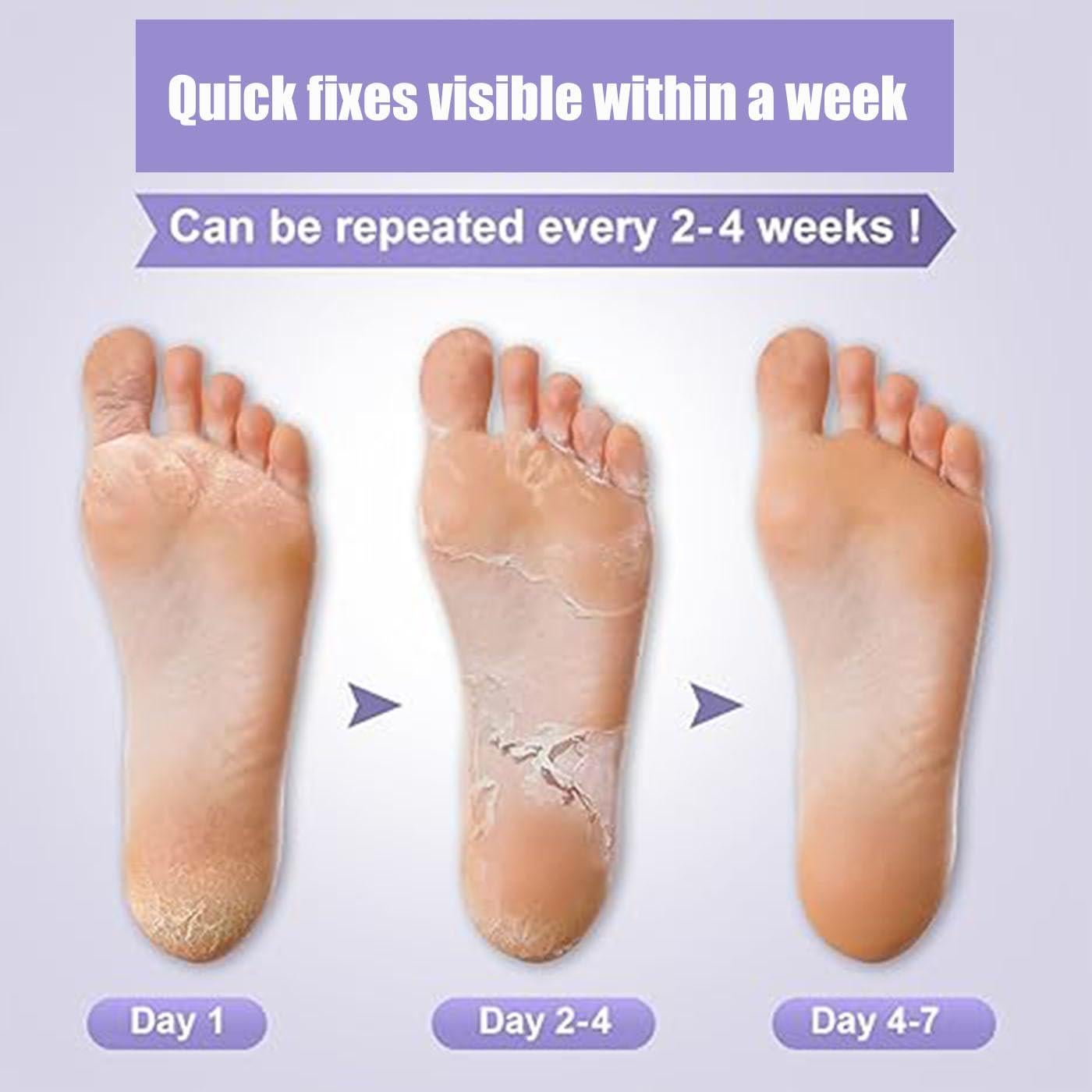 Mascarilla Exfoliante para Pies Mckkymi - 5 Paquetes Aroma Lavanda