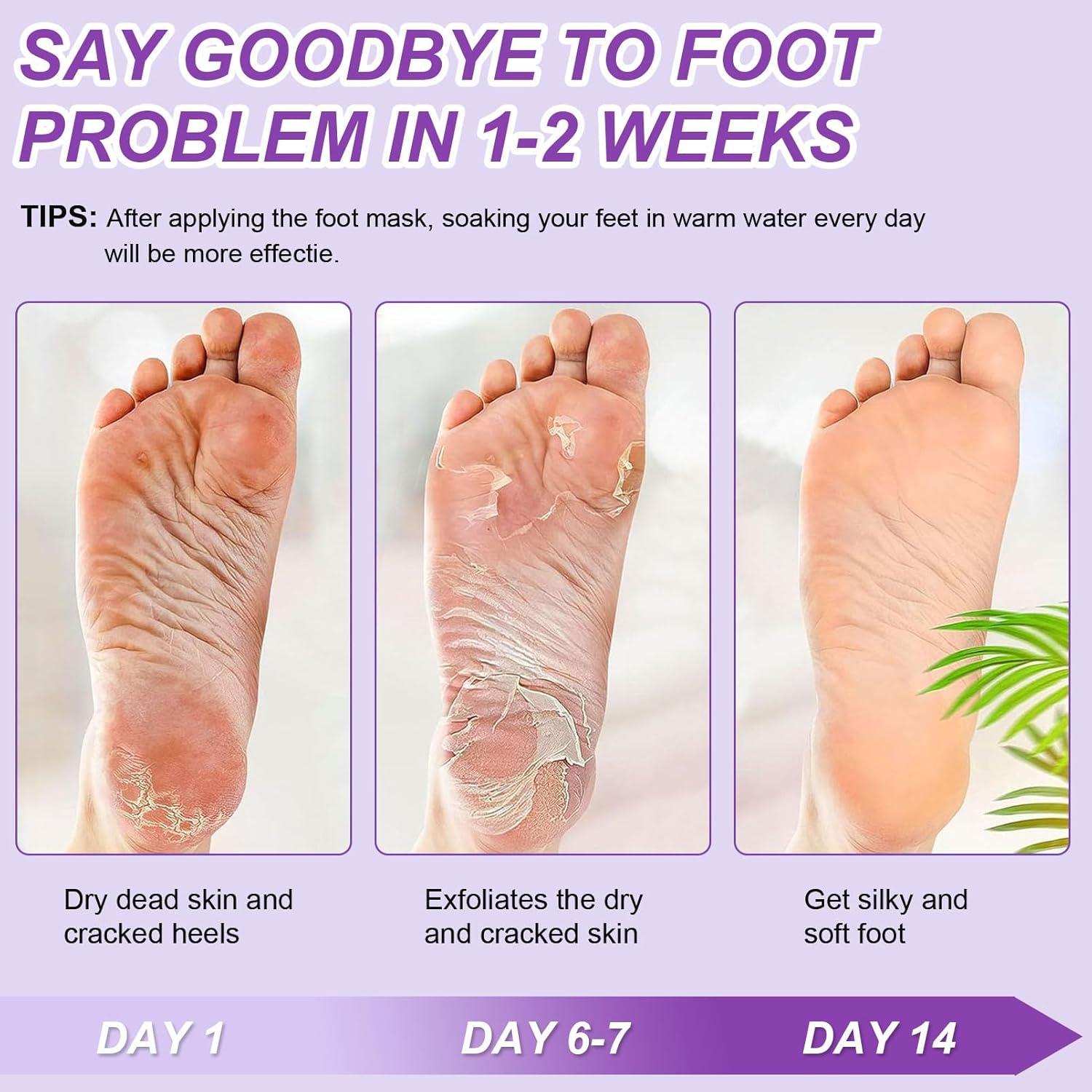 Mascarillas Exfoliantes para Pies NovaCharm - 9 Pares Hidratantes