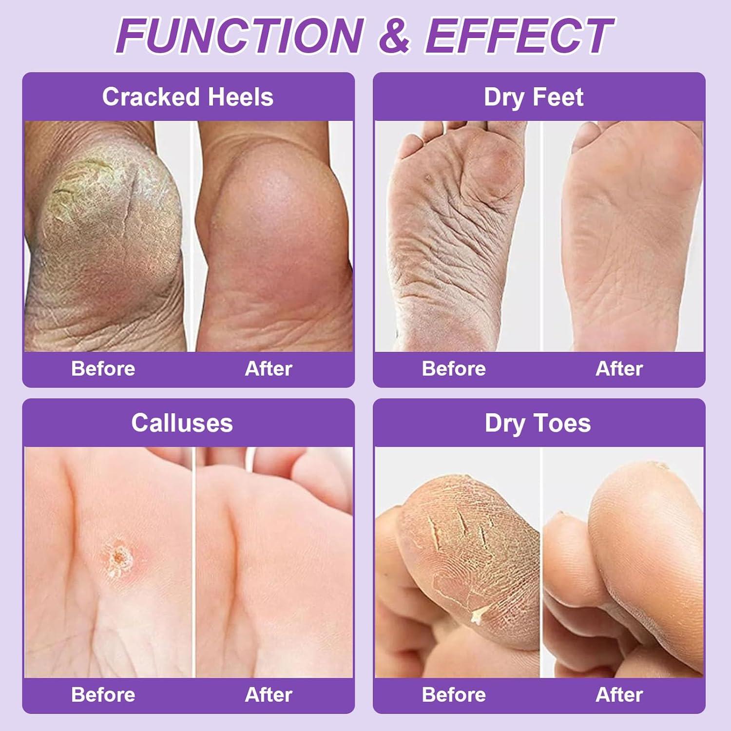 Mascarillas Exfoliantes para Pies NovaCharm - 9 Pares Hidratantes