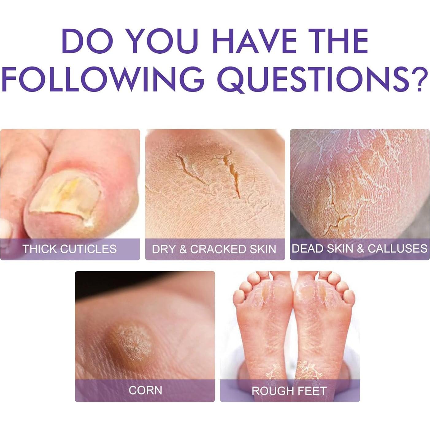 Mascarillas Exfoliantes para Pies NovaCharm - 9 Pares Hidratantes