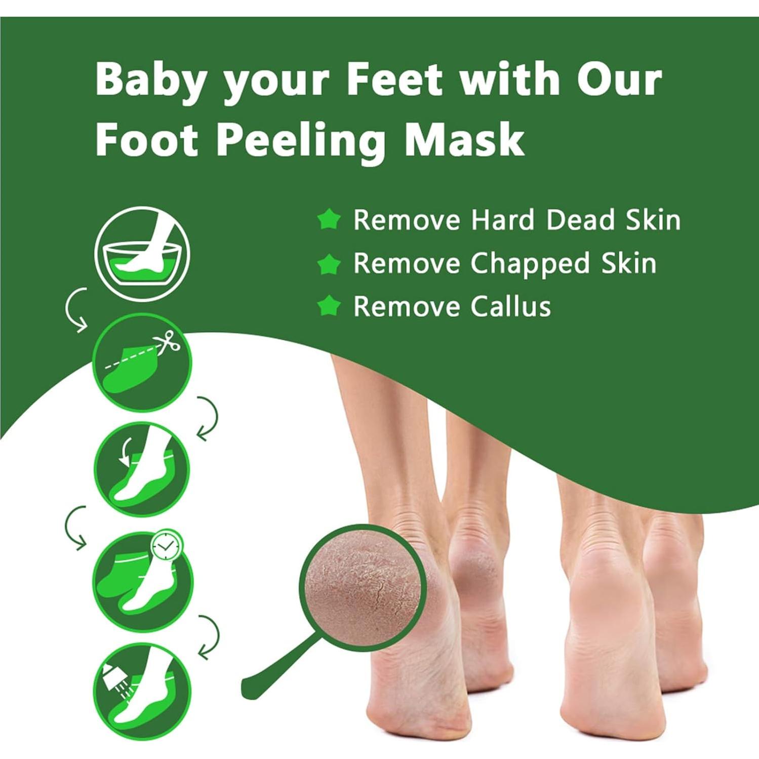 Mascarilla Exfoliante para Pies Newh3c - 5 Paquetes, Talones Suaves