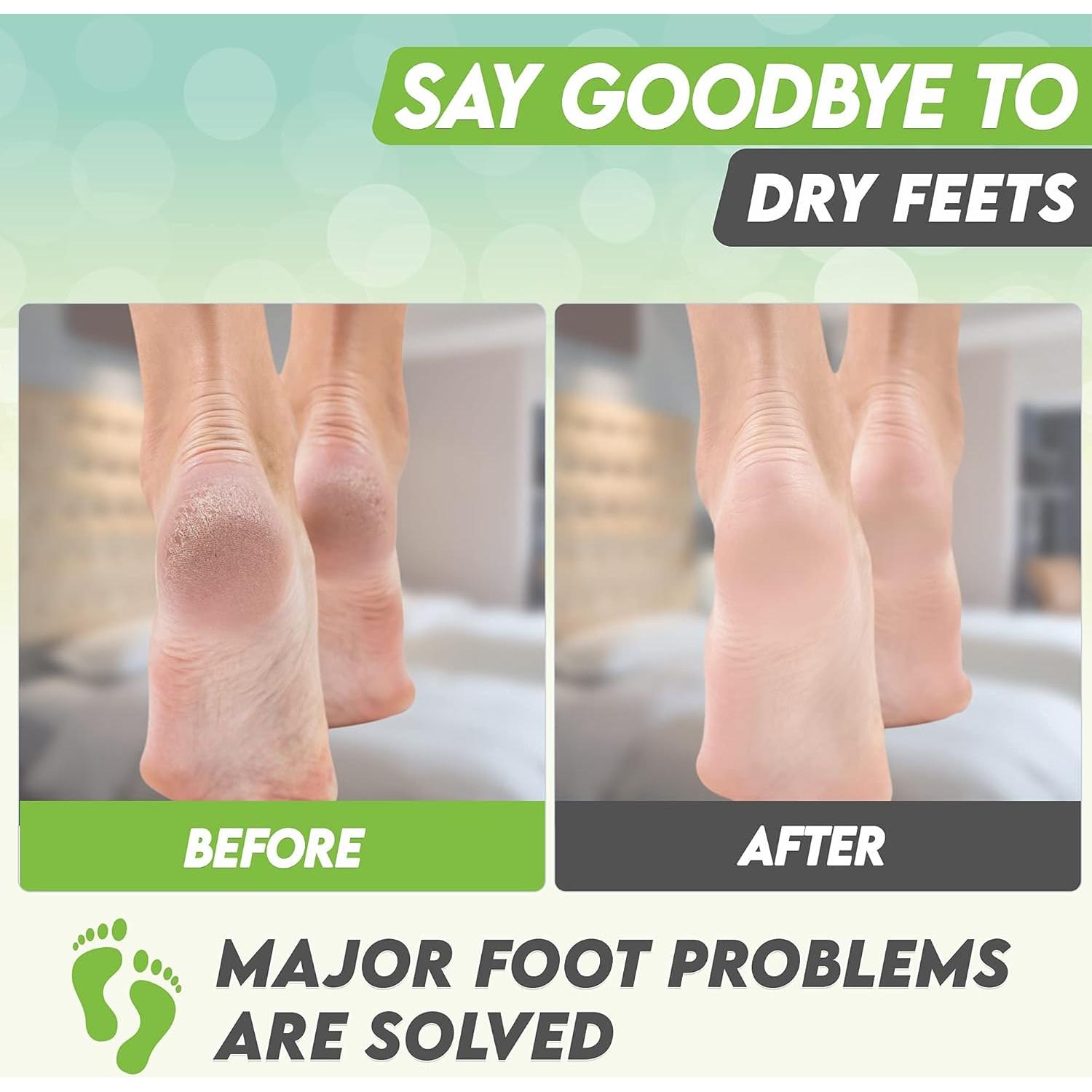 Mascarilla Exfoliante para Pies Karma Organic - Té Verde Hidratante, 2 Unidades