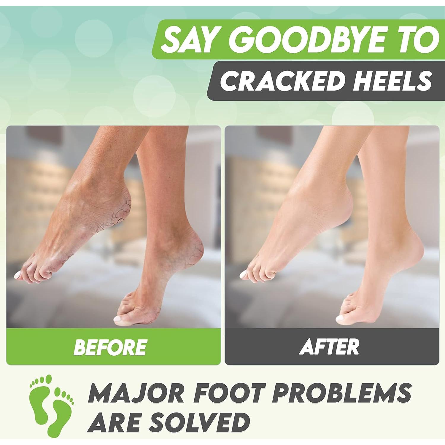 Mascarilla Exfoliante para Pies Karma Organic - Té Verde Hidratante, 2 Unidades